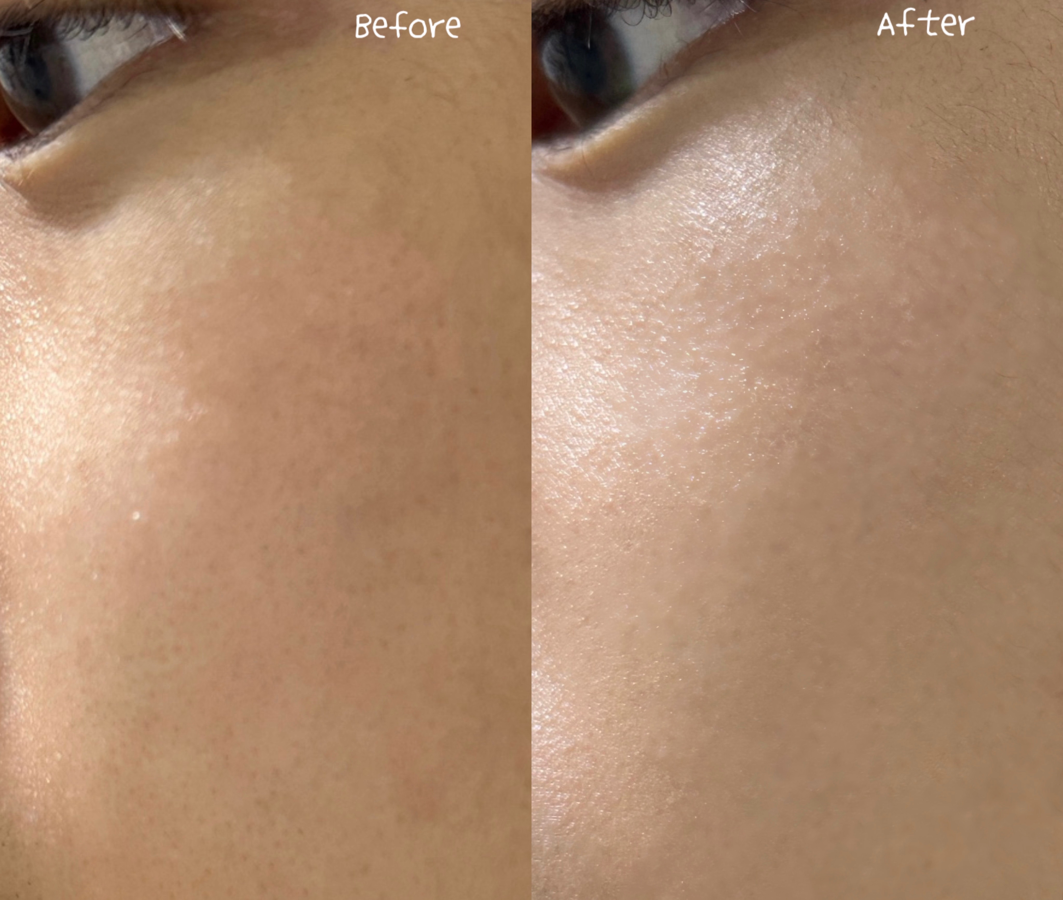 피드이미지정보-2