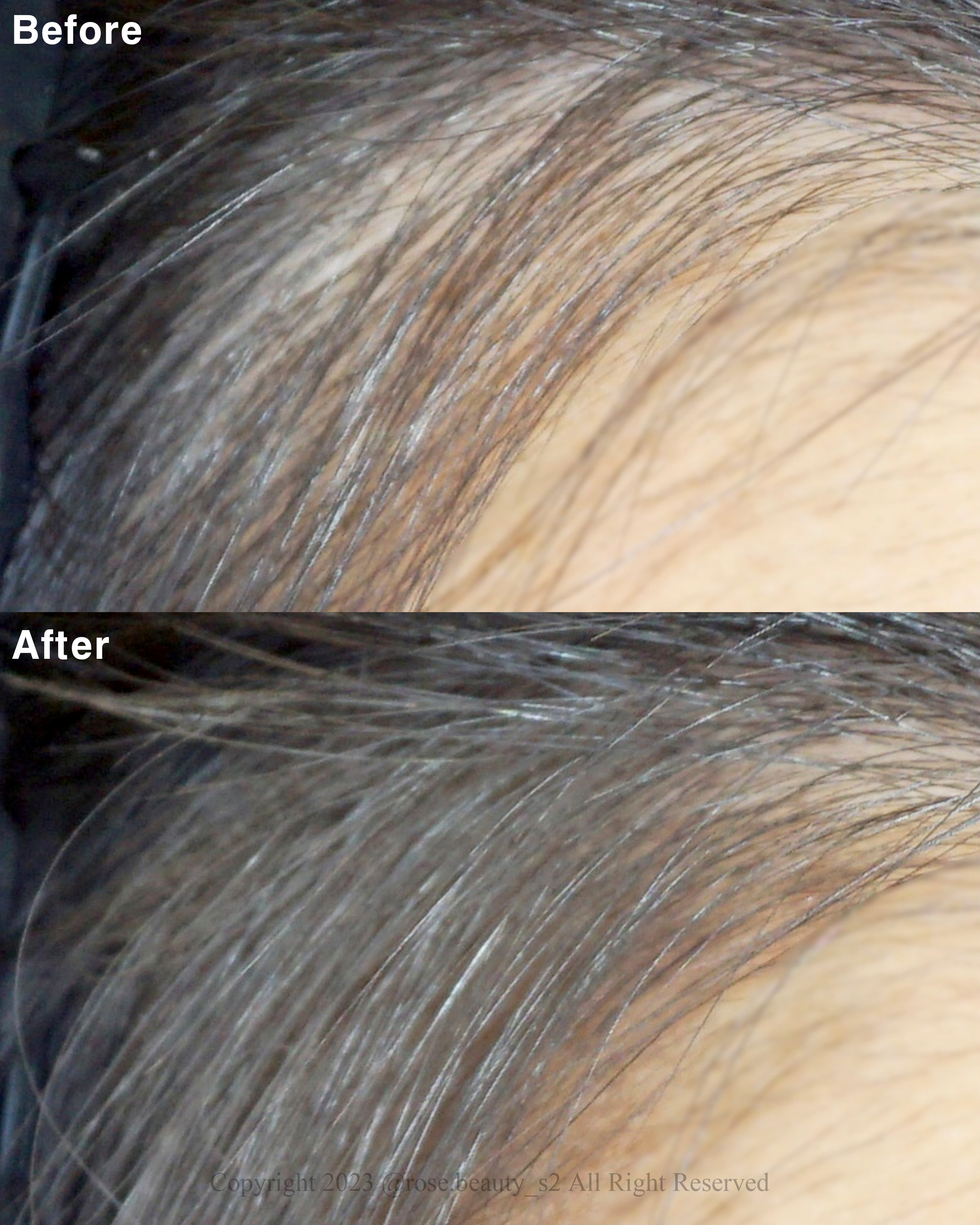 피드이미지정보-4