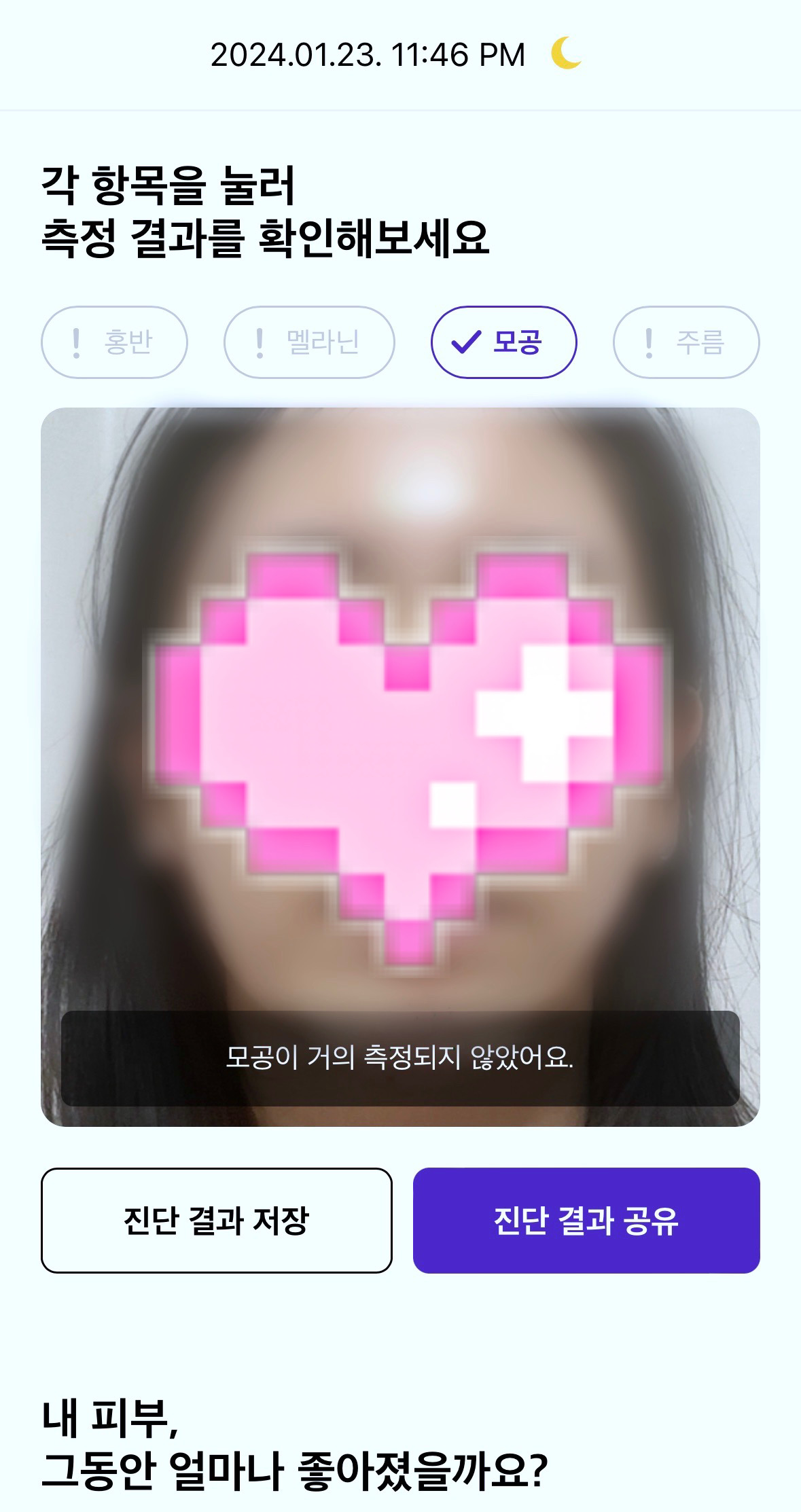 피드이미지정보-1