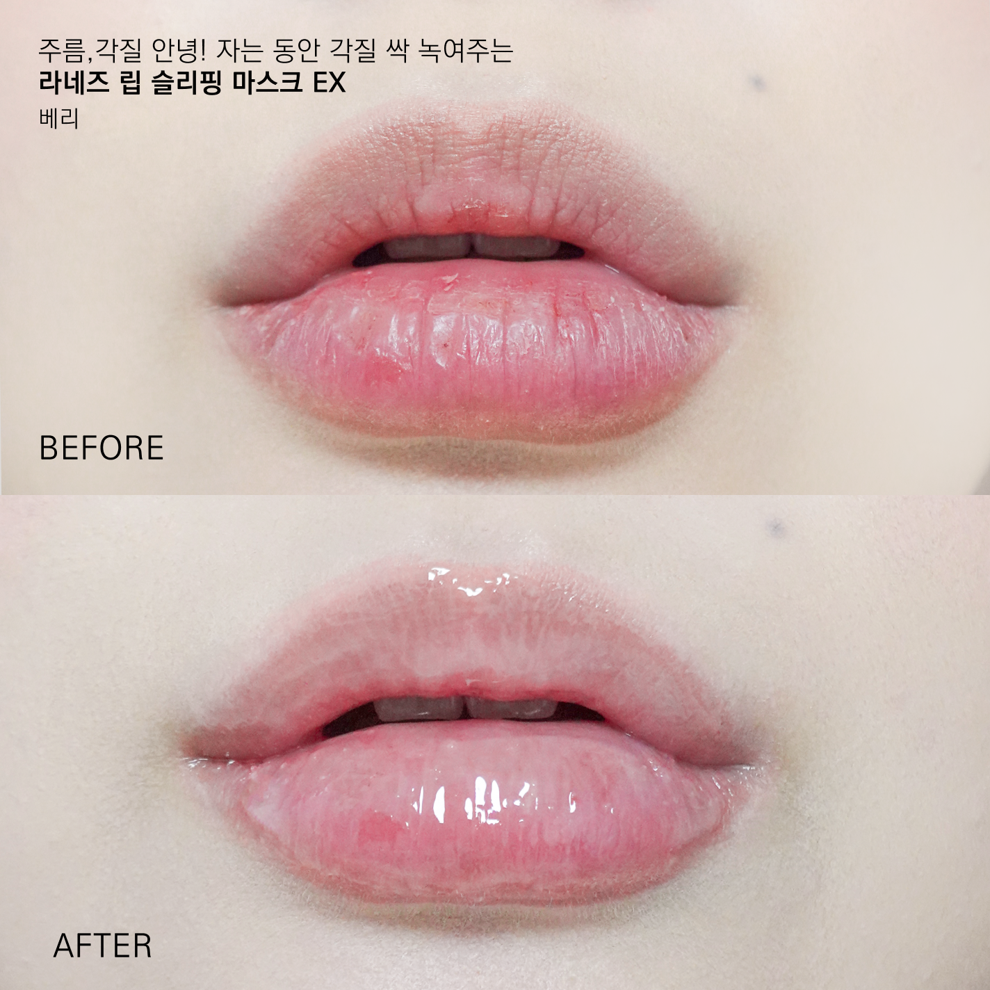 피드이미지정보-2