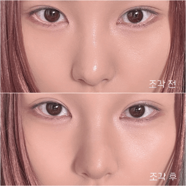 피드이미지정보-0