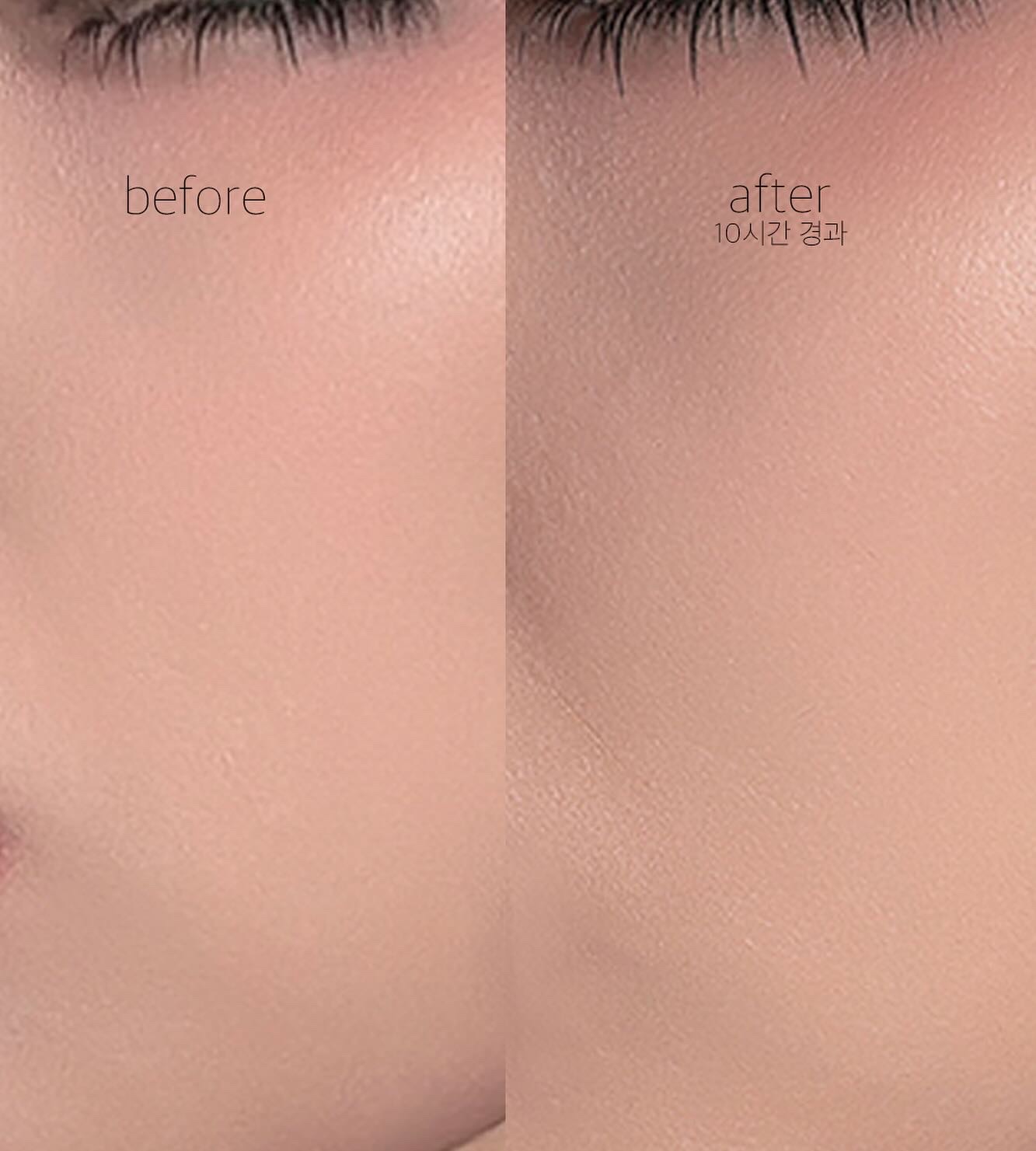 피드이미지정보-3