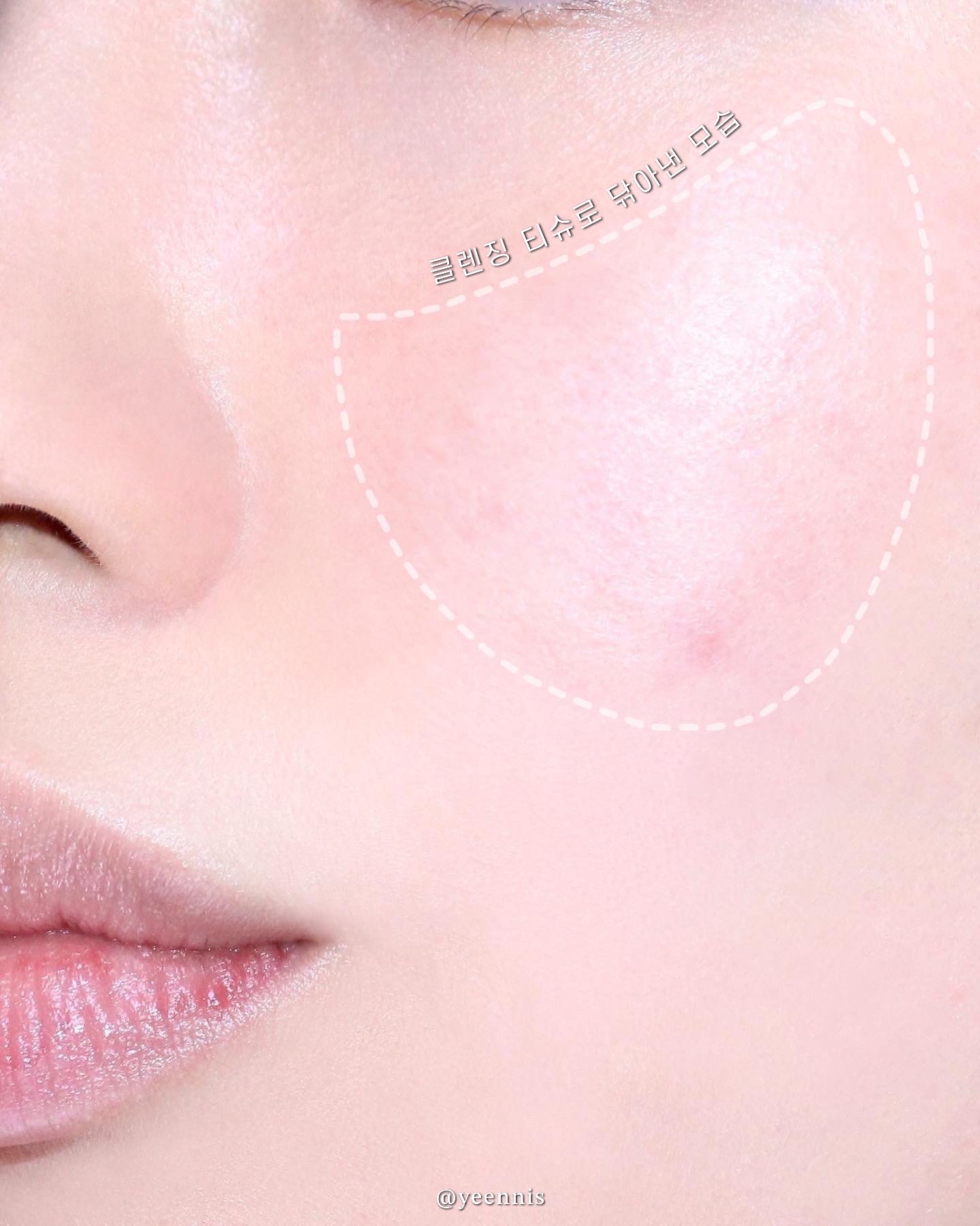 피드이미지정보-7