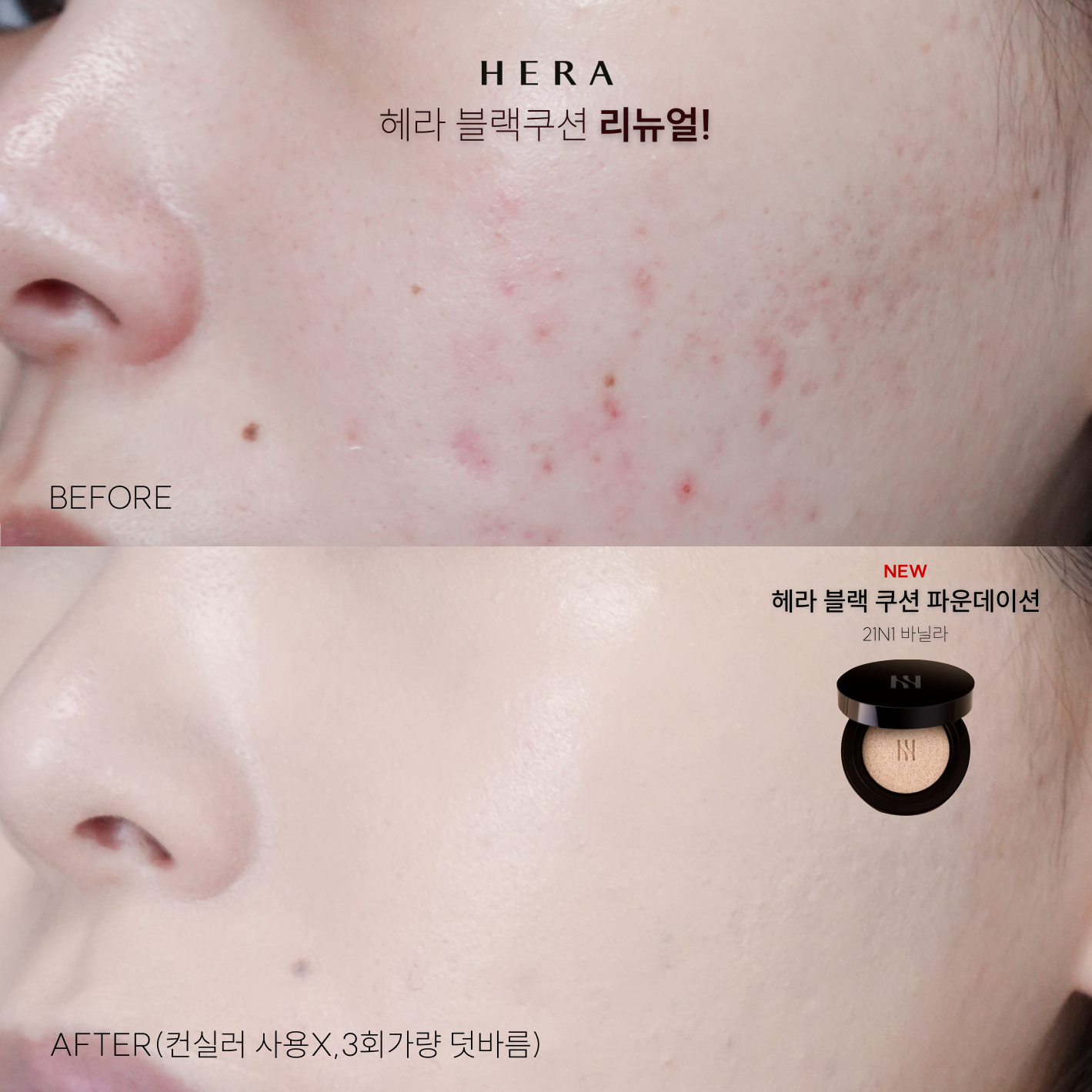 피드이미지정보-1