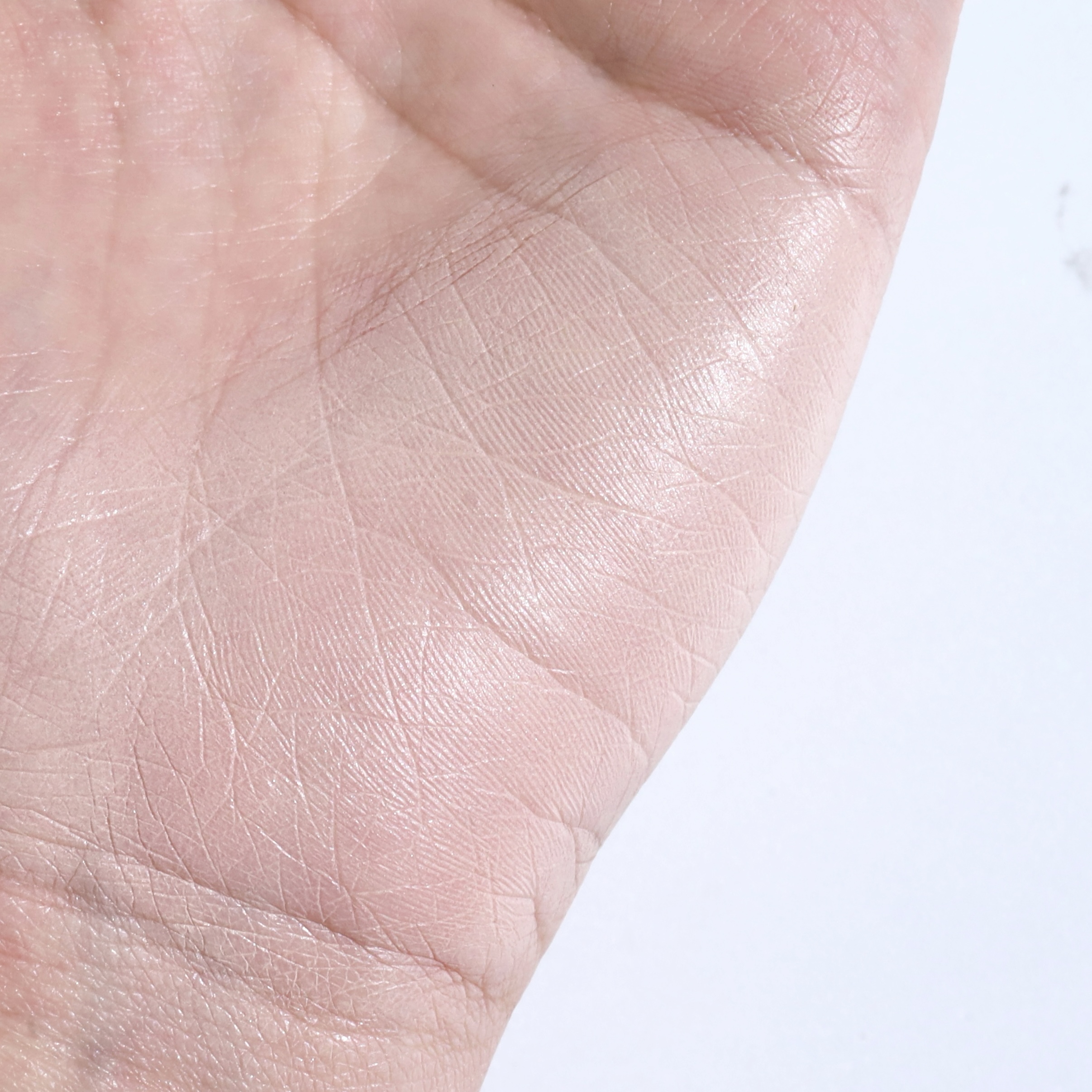 피드이미지정보-3