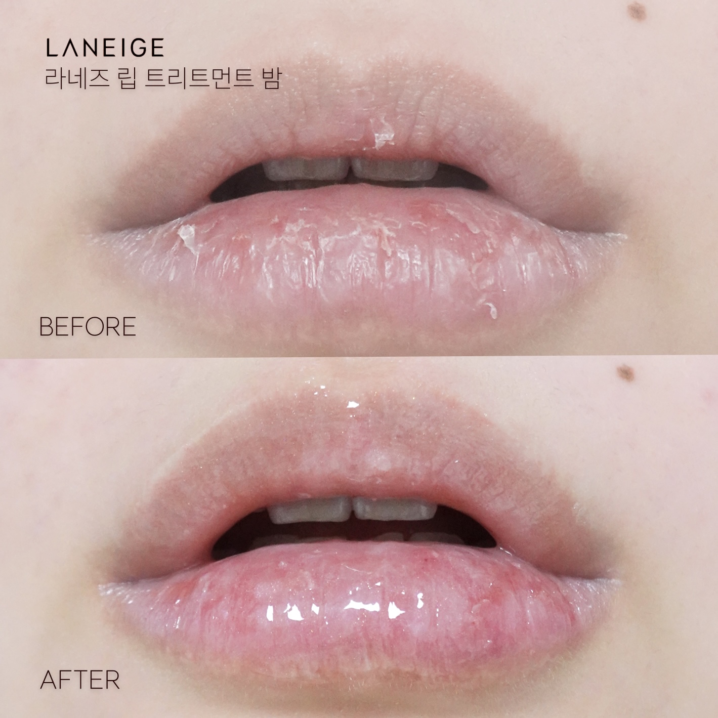 피드이미지정보-0