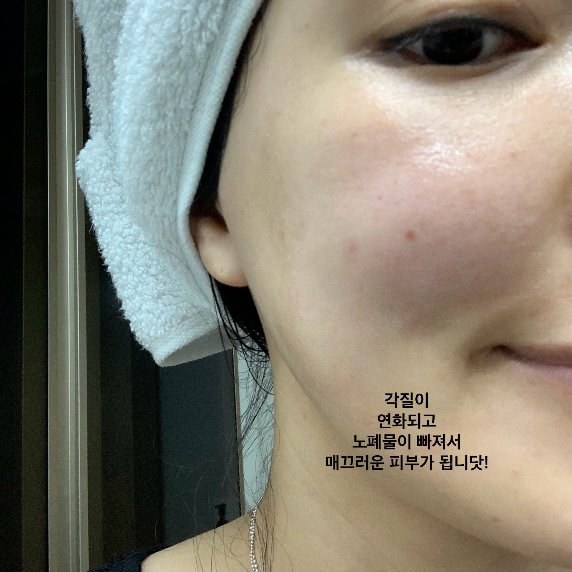 피드이미지정보-4