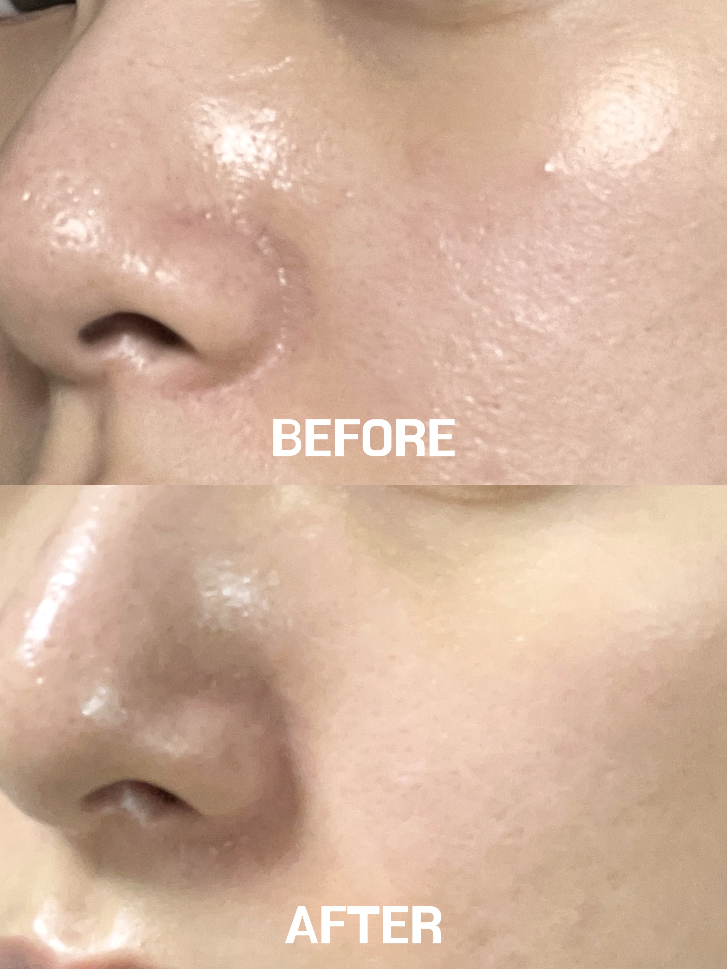 피드이미지정보-5