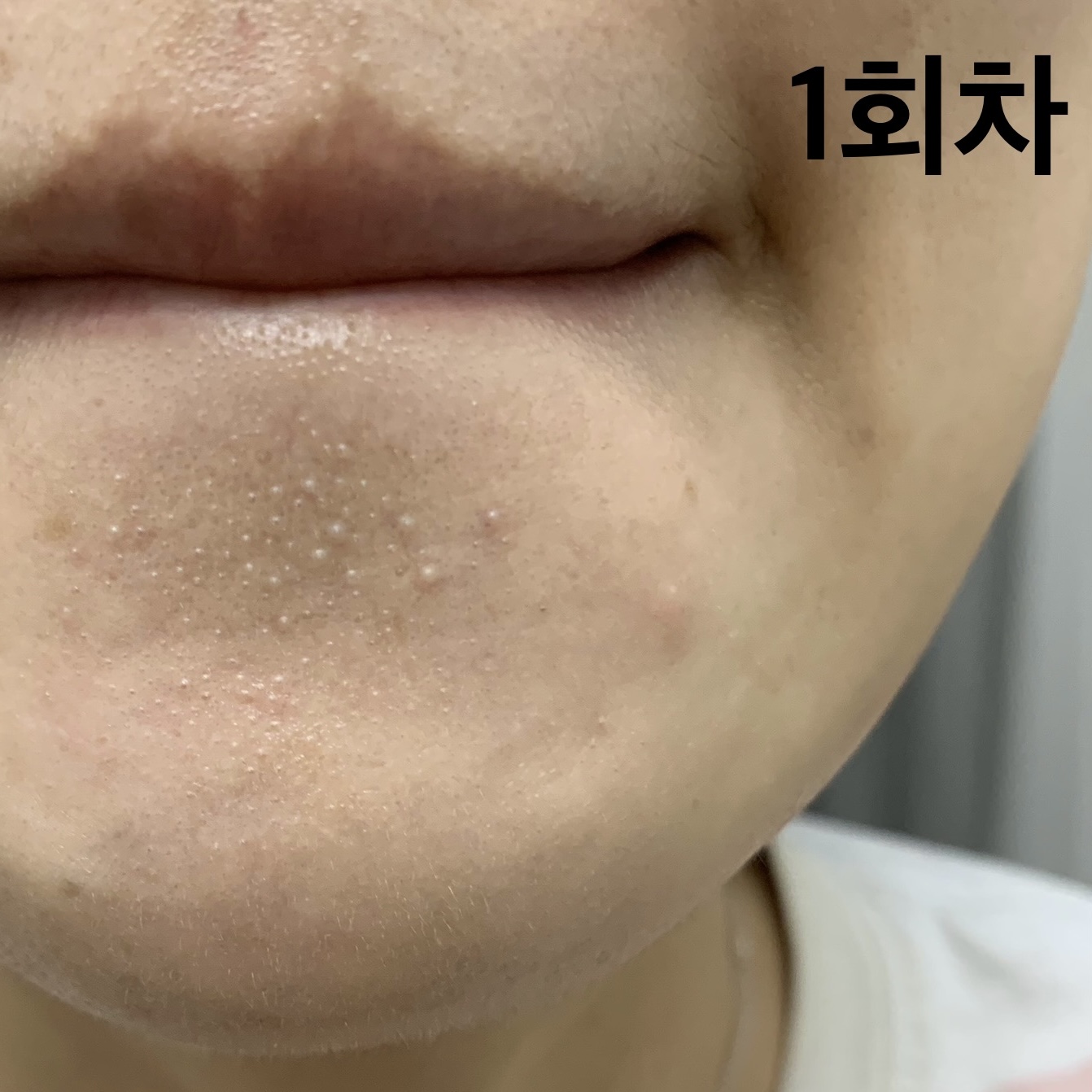 피드이미지정보-9