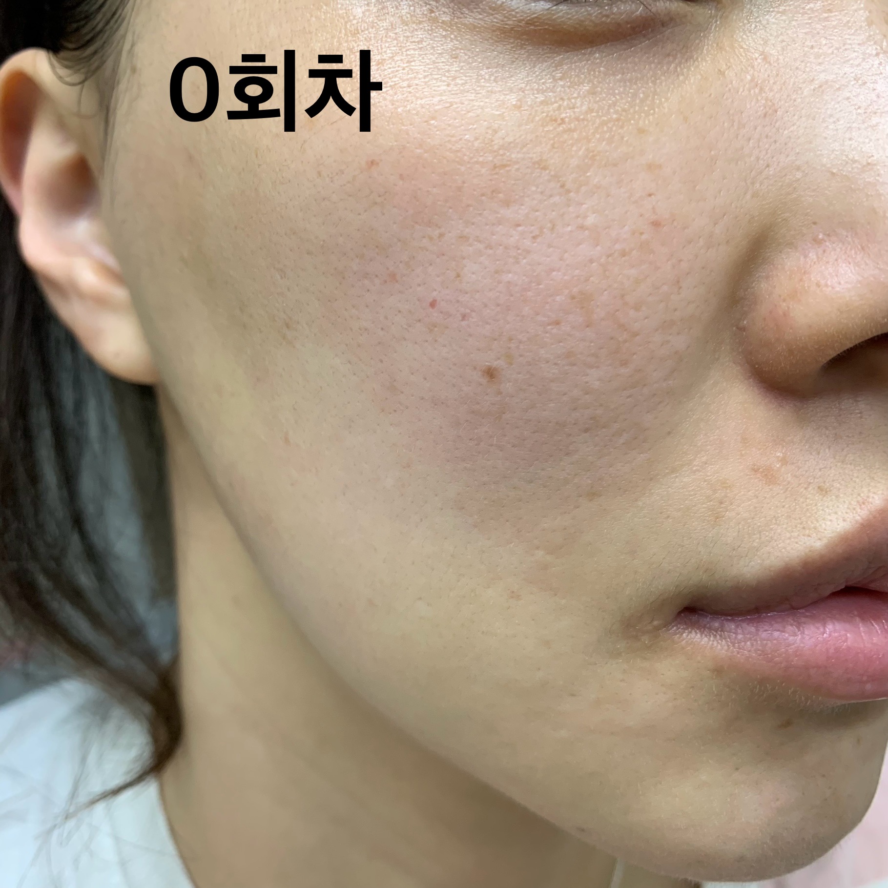 피드이미지정보-7