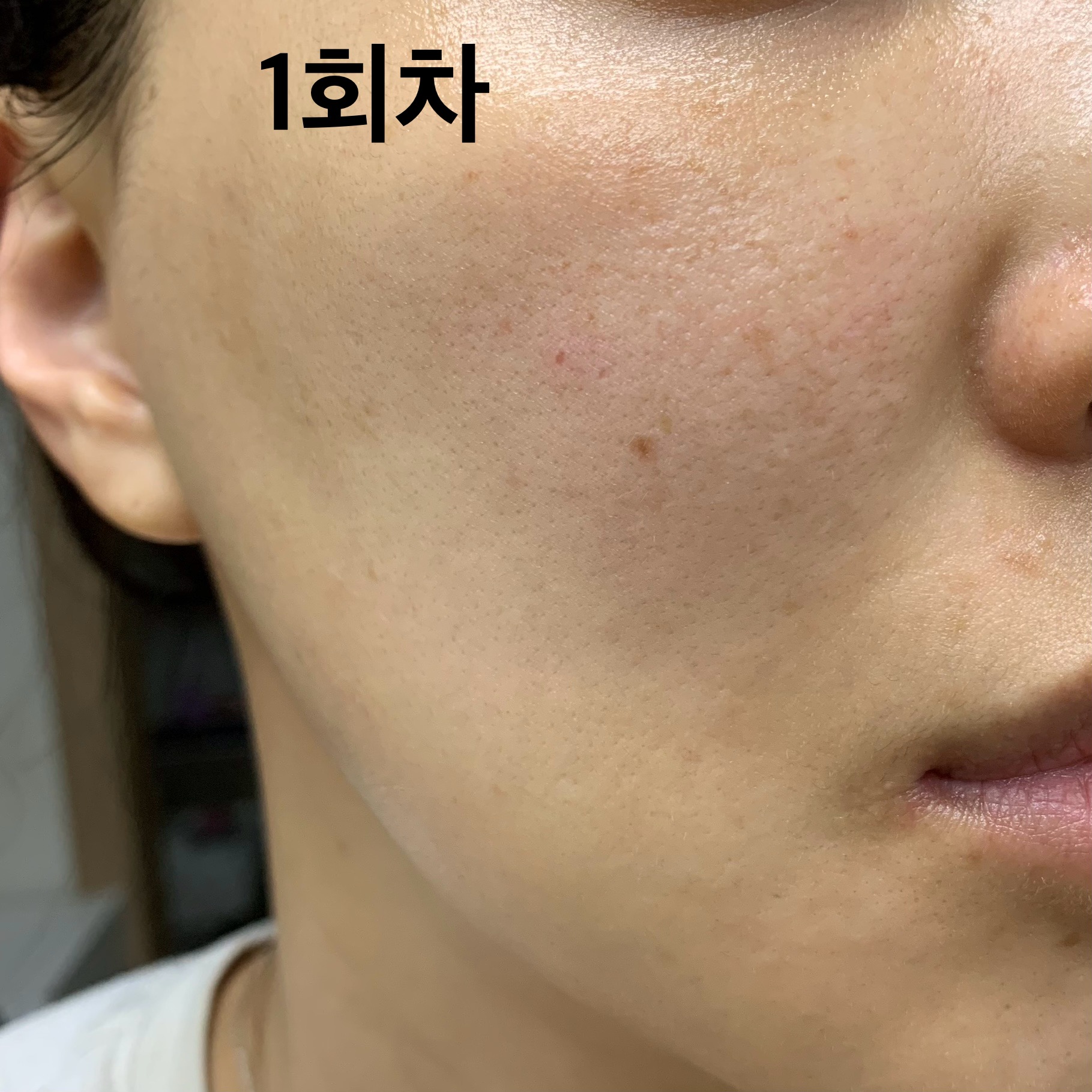 피드이미지정보-8