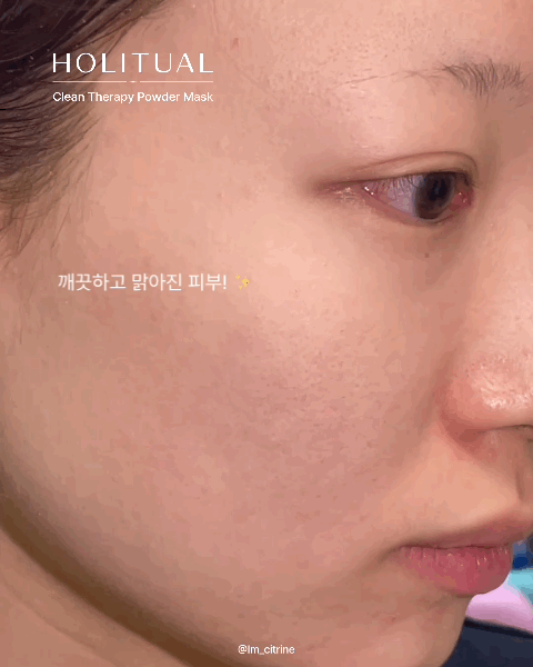 피드이미지정보-7