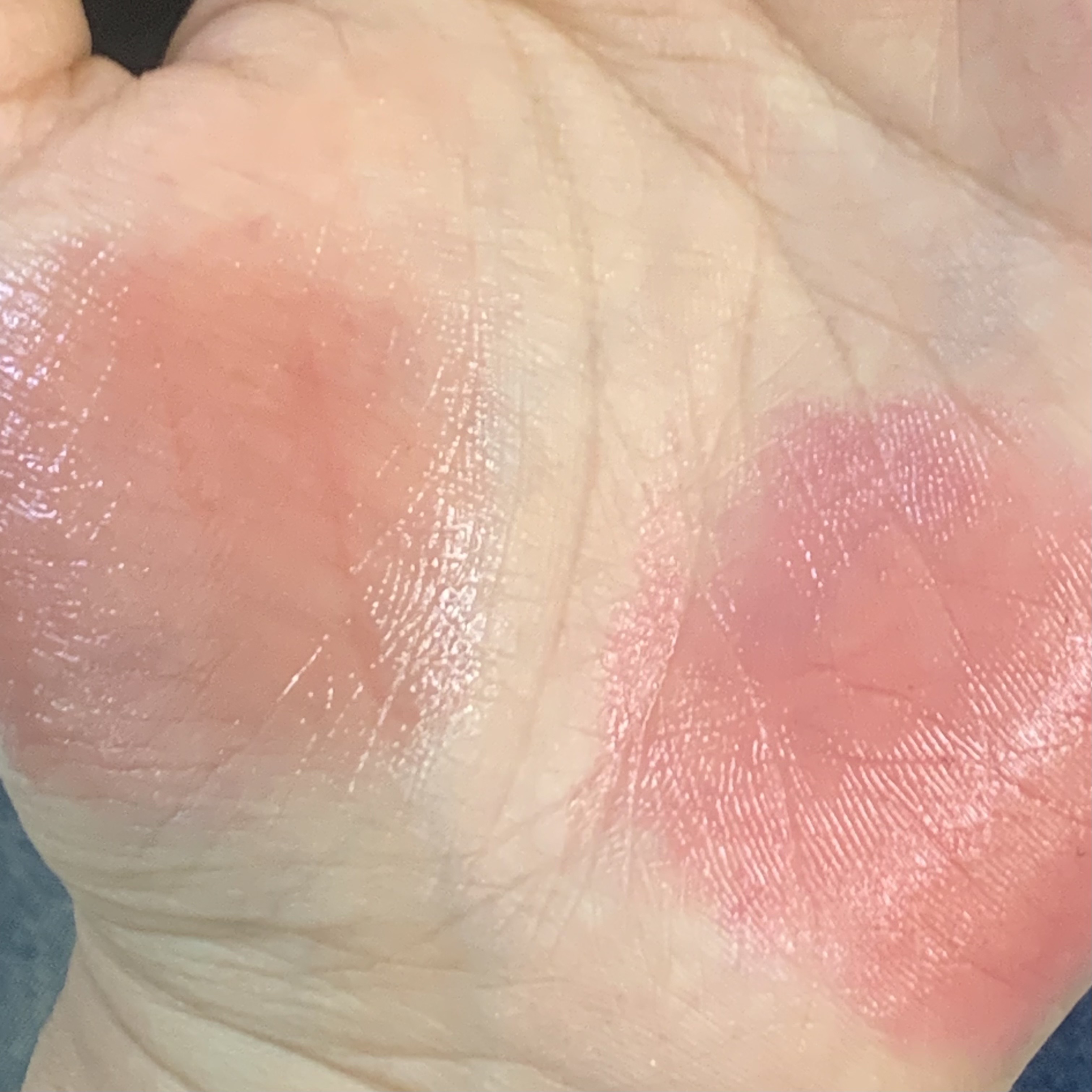 피드이미지정보-6