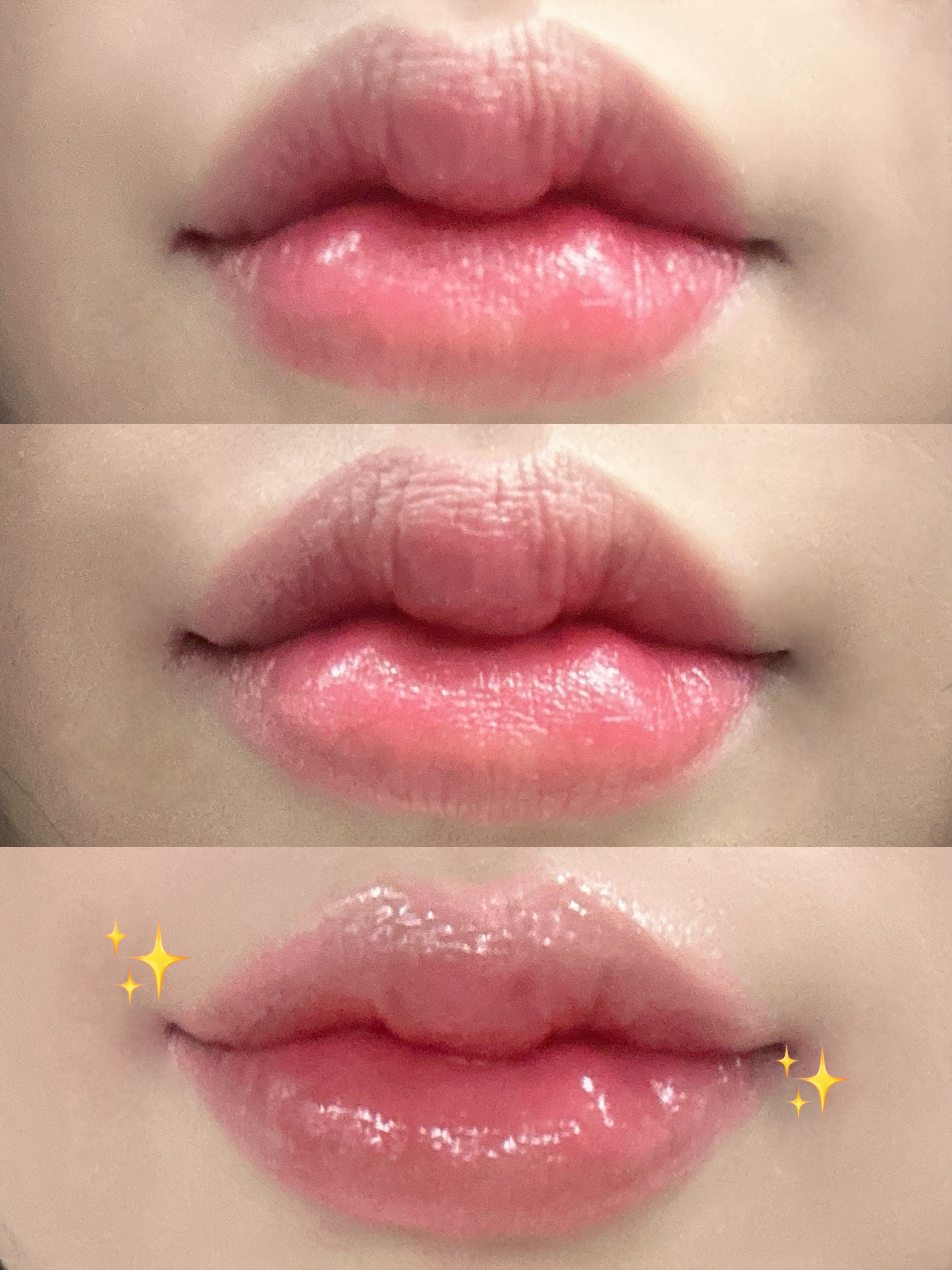 피드이미지정보-2