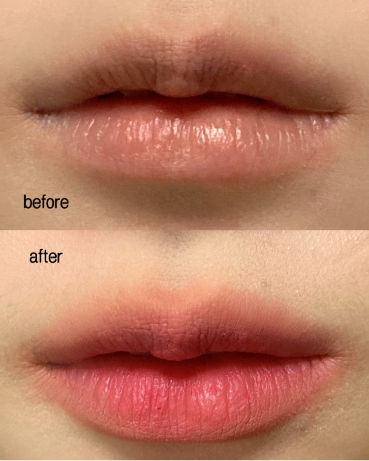 피드이미지정보-4