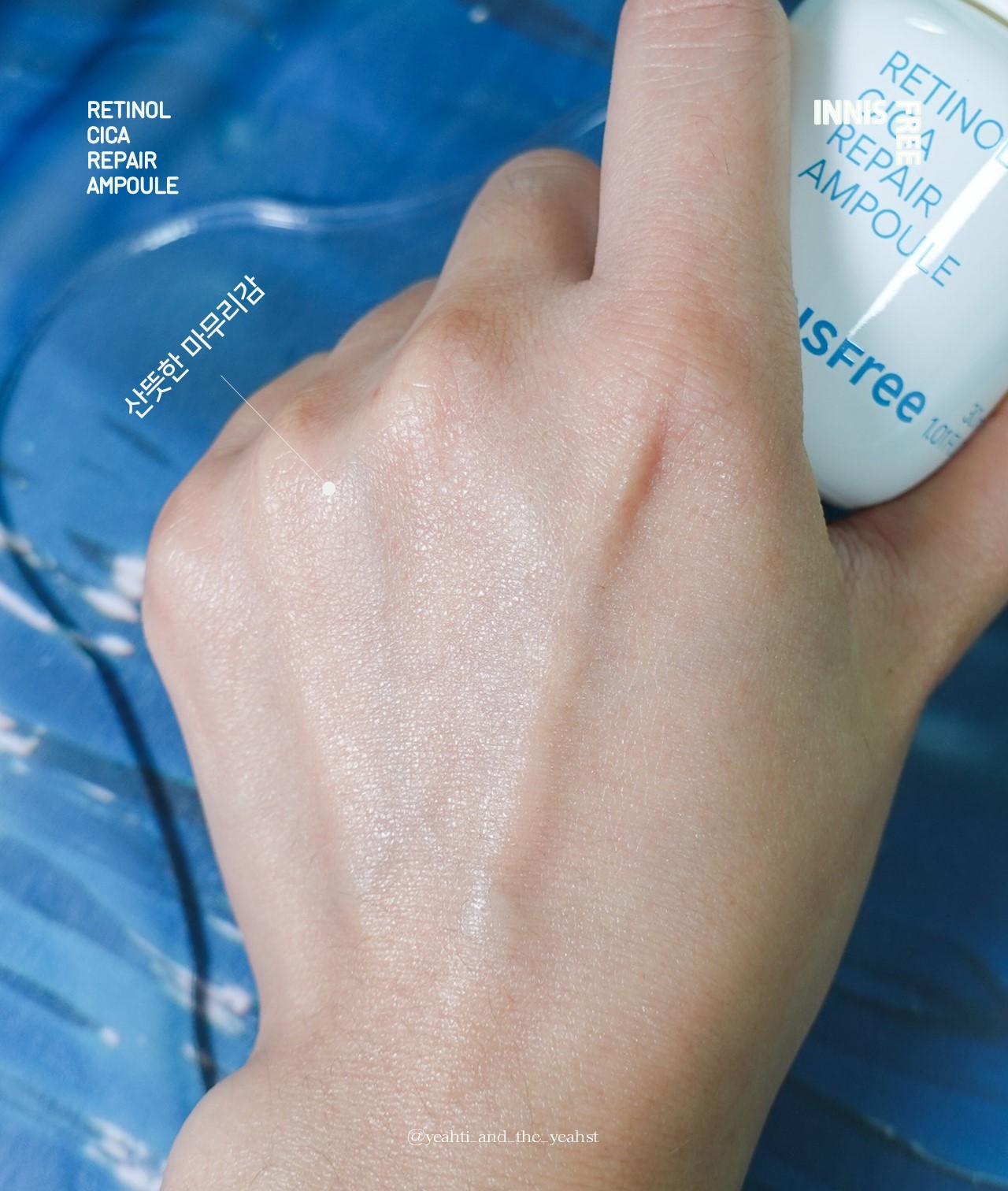 피드이미지정보-7