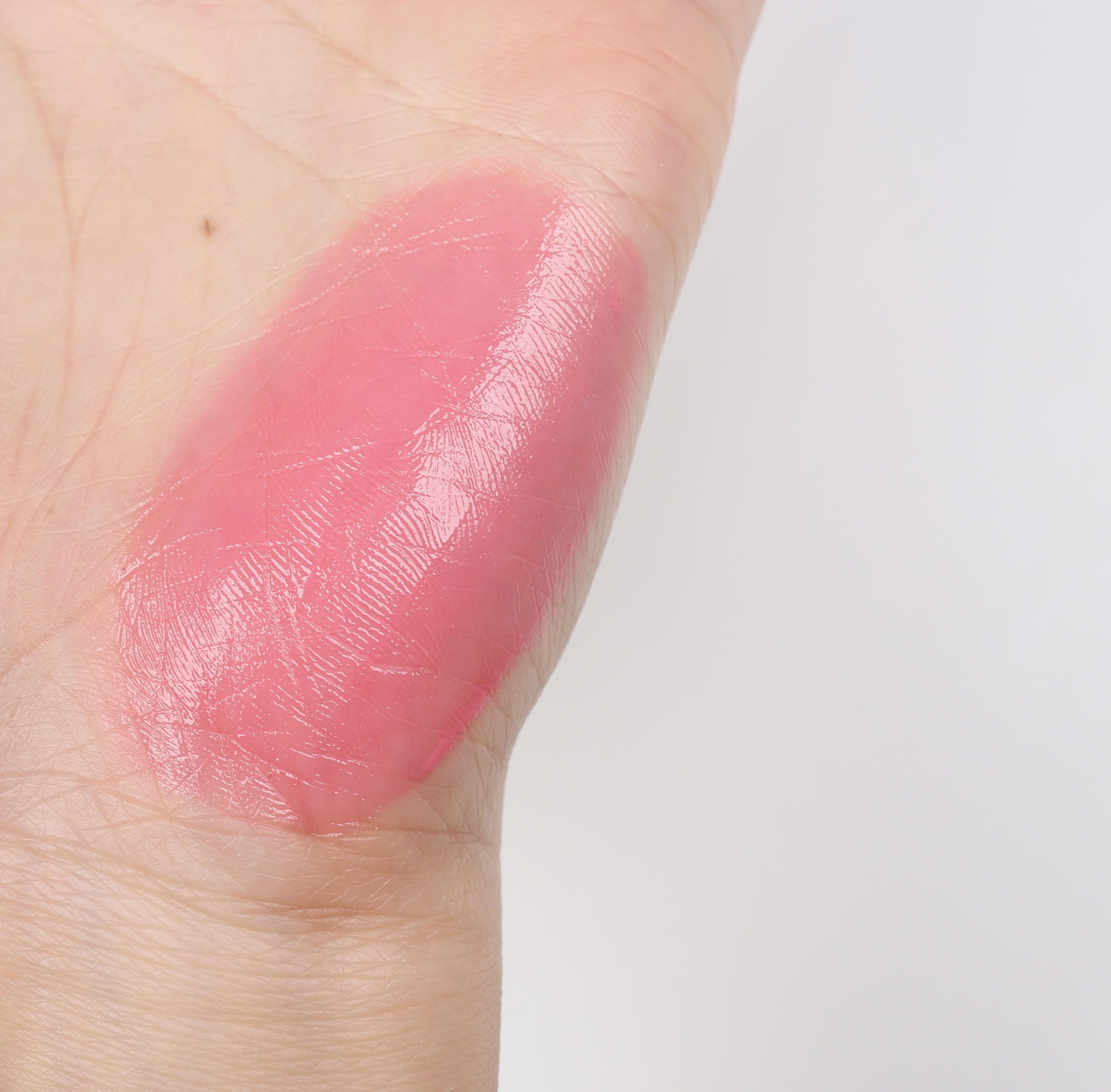 피드이미지정보-1