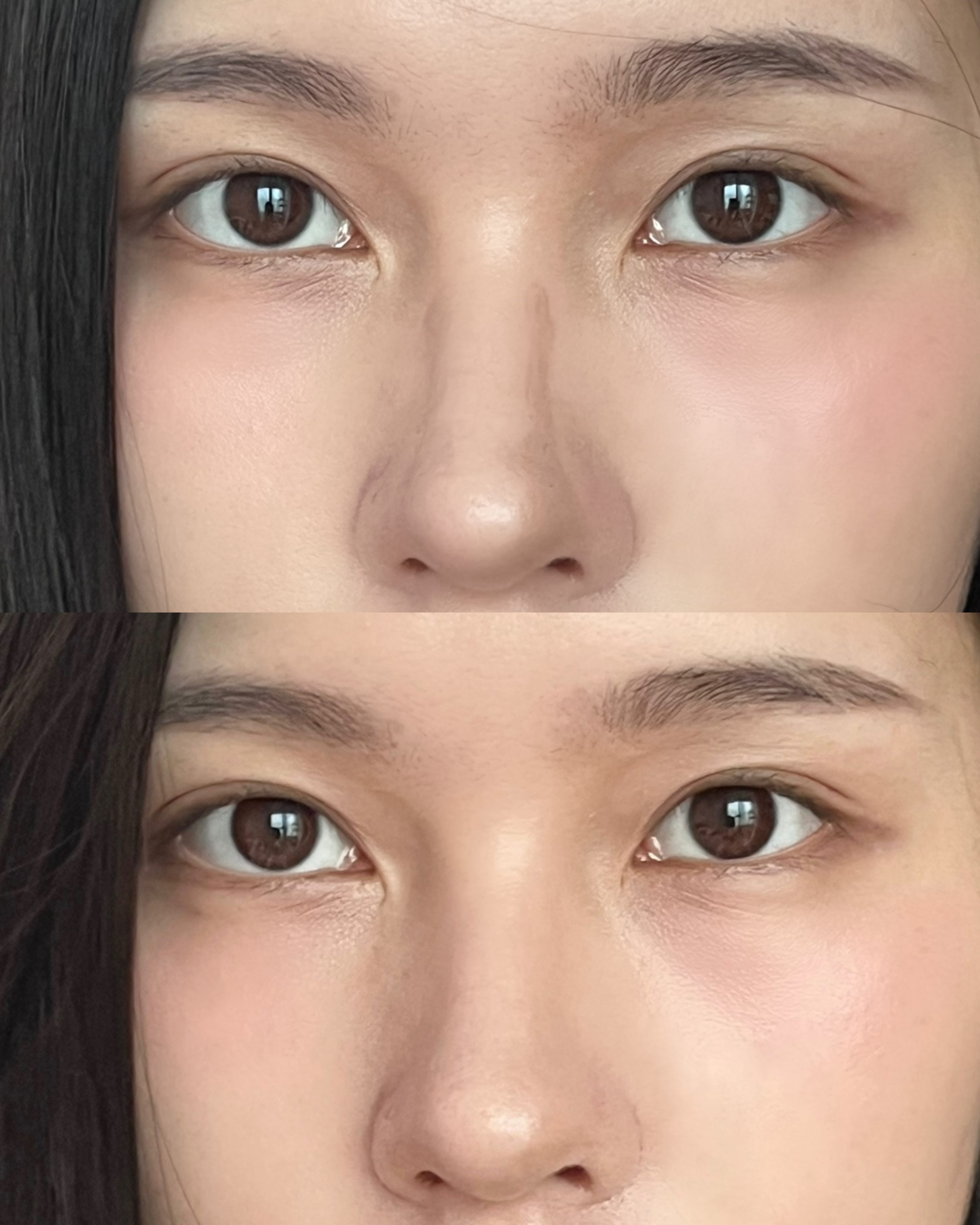 피드이미지정보-0