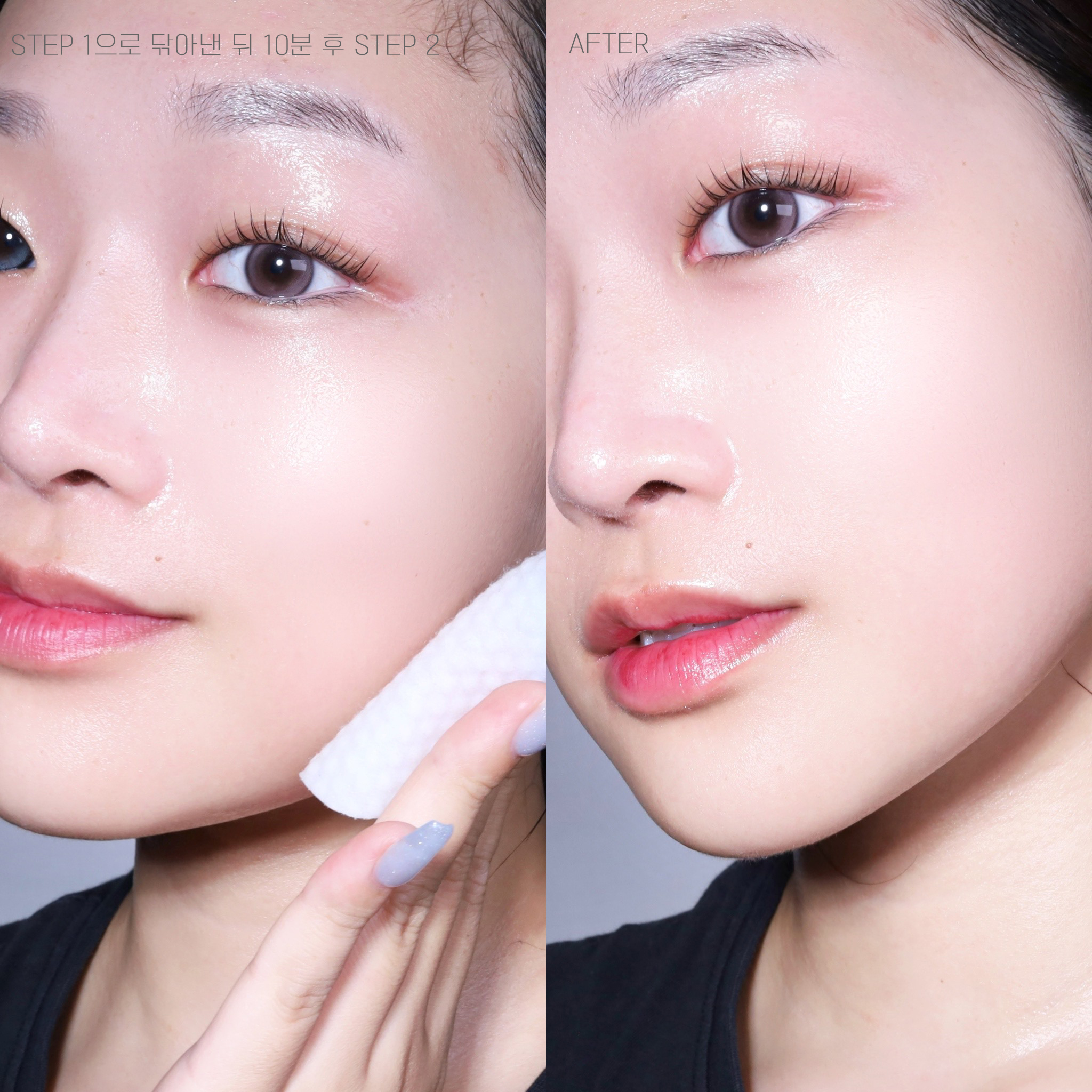 피드이미지정보-5