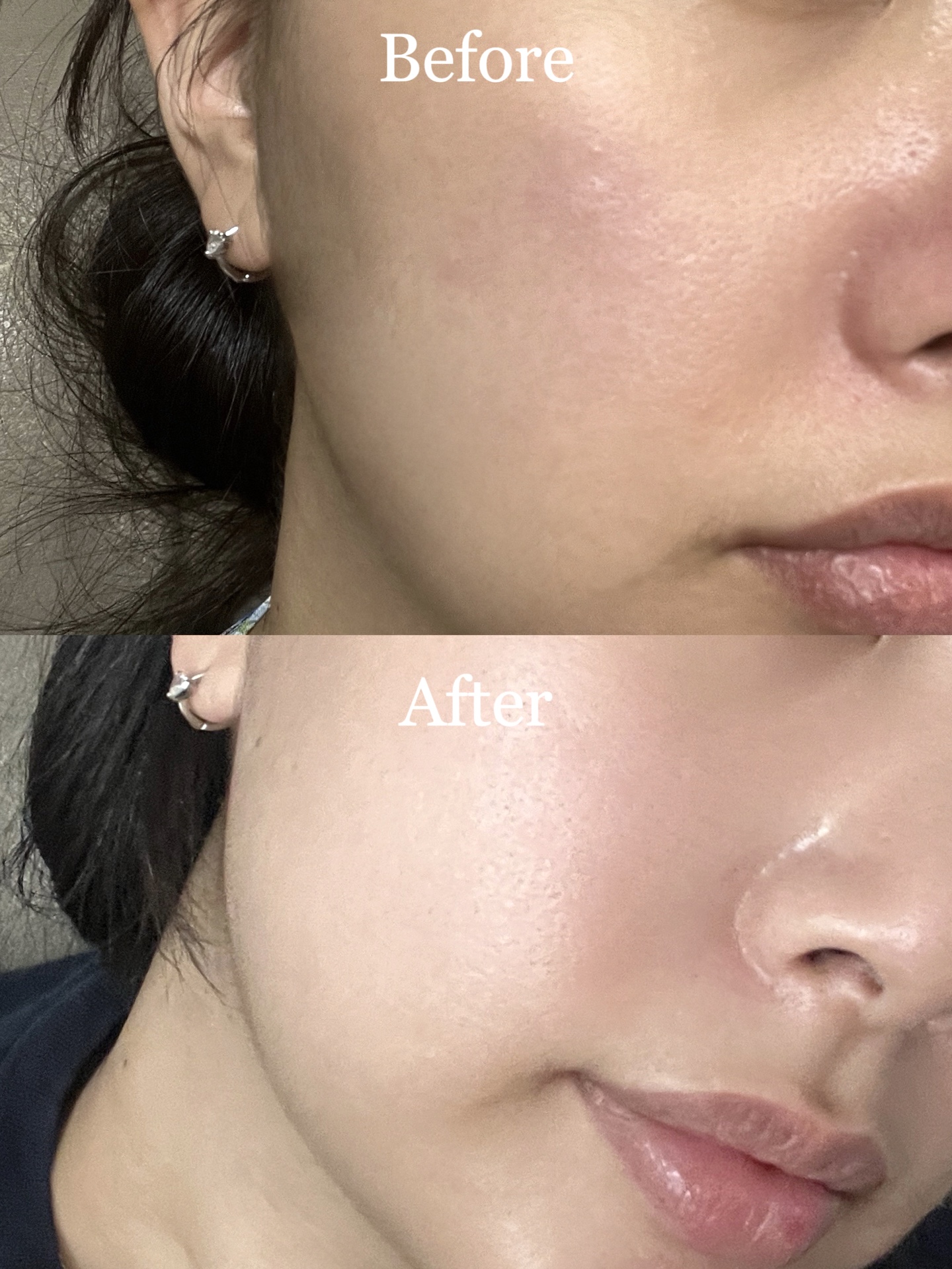 피드이미지정보-6