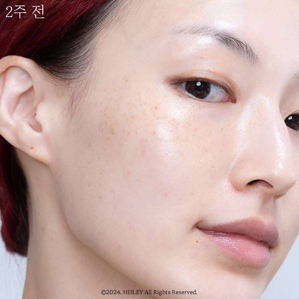 피드이미지정보-0