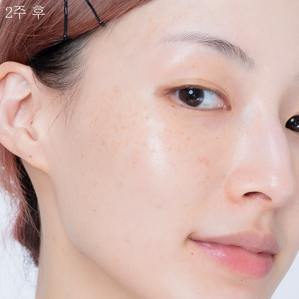 피드이미지정보-4