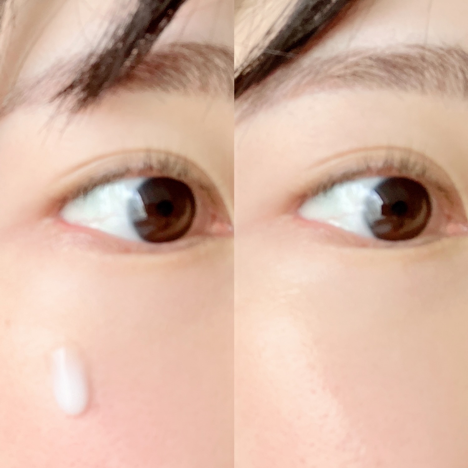 피드이미지정보-2