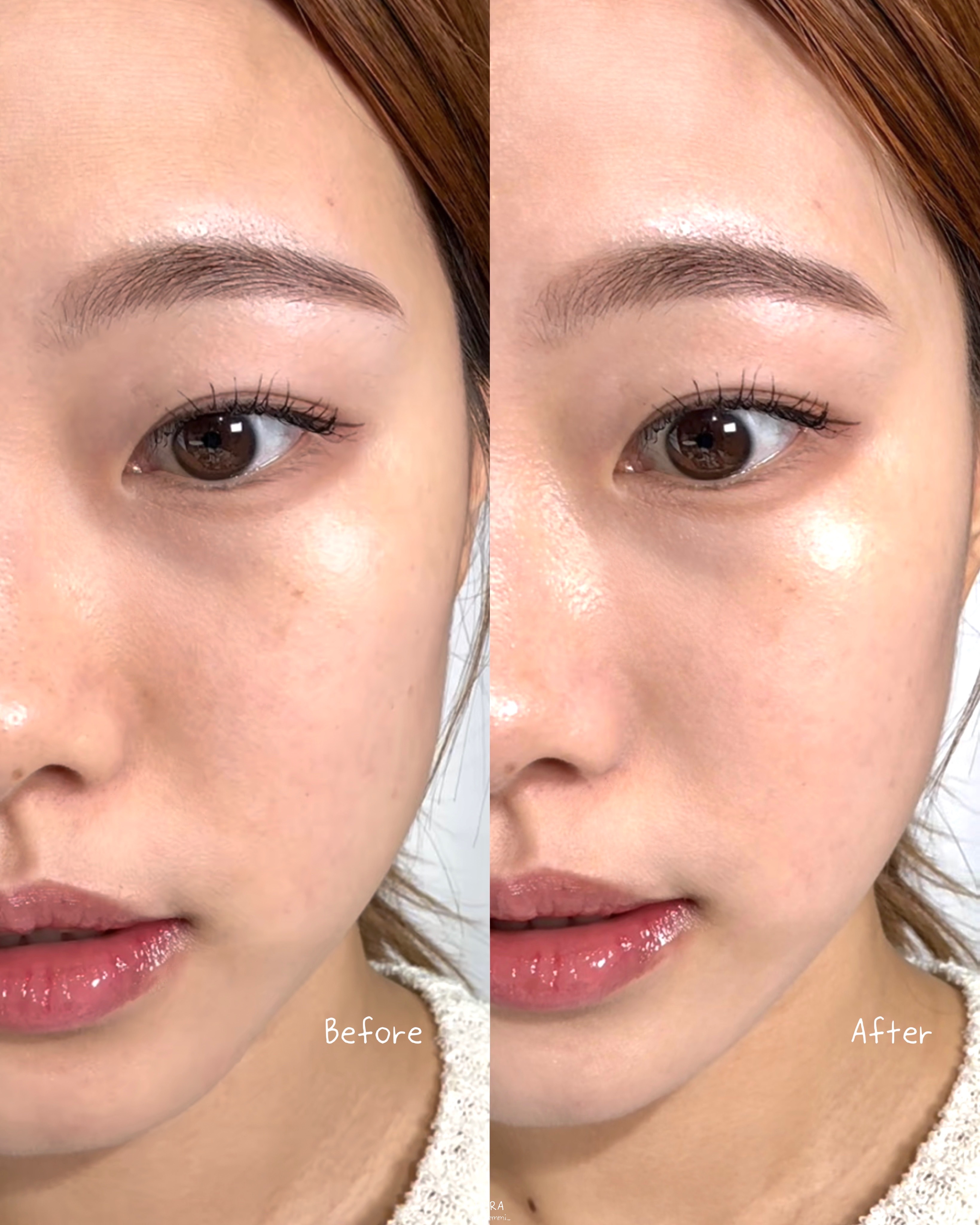 피드이미지정보-7