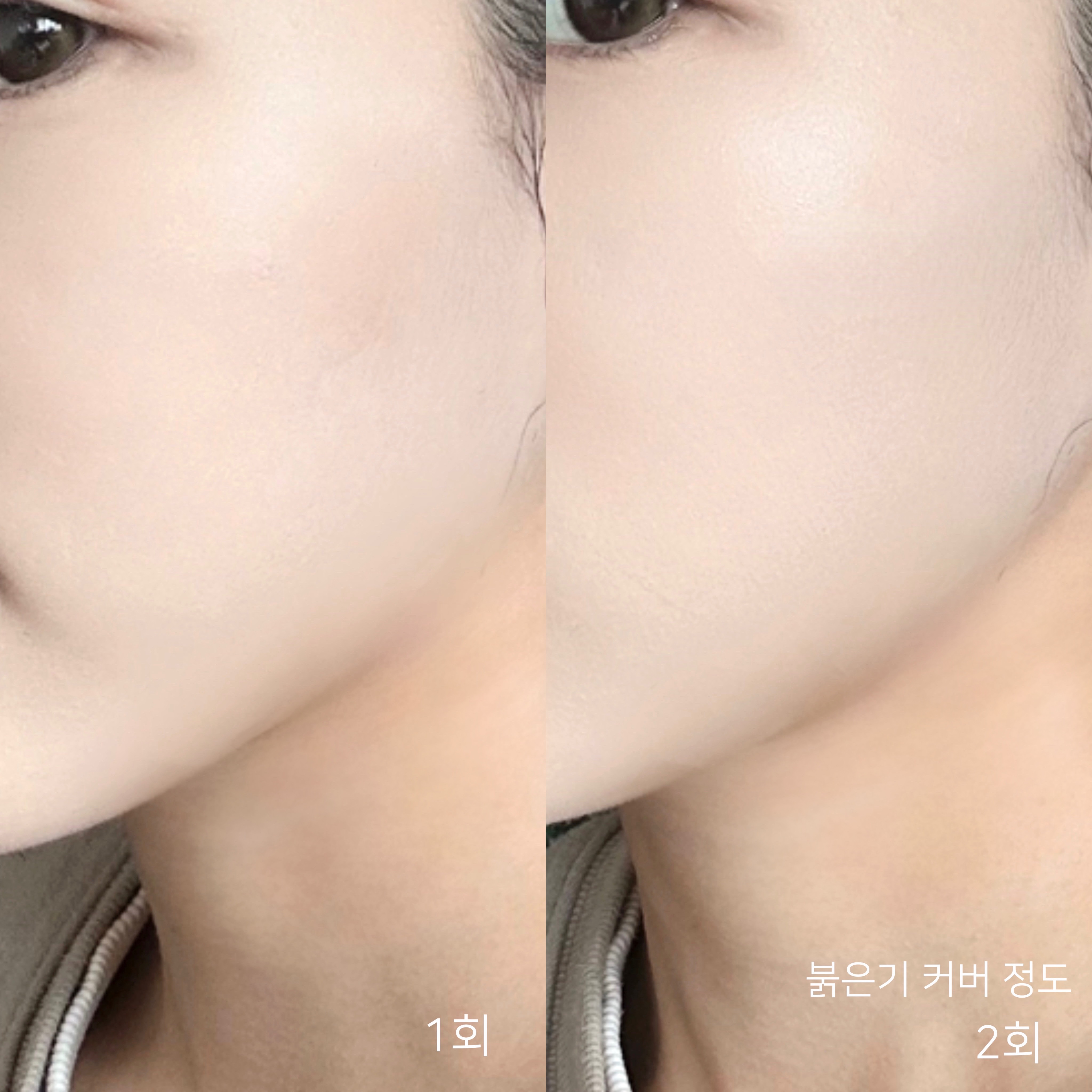 피드이미지정보-4