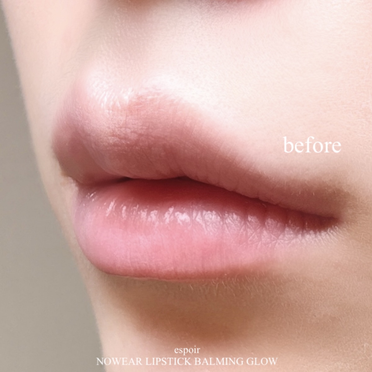 피드이미지정보-2