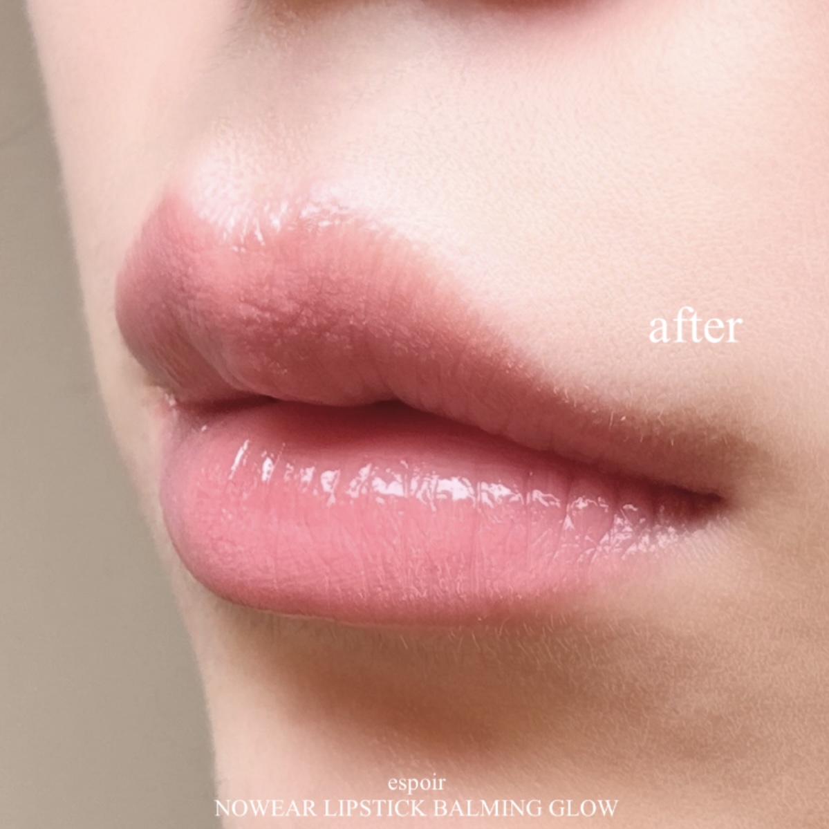 피드이미지정보-3