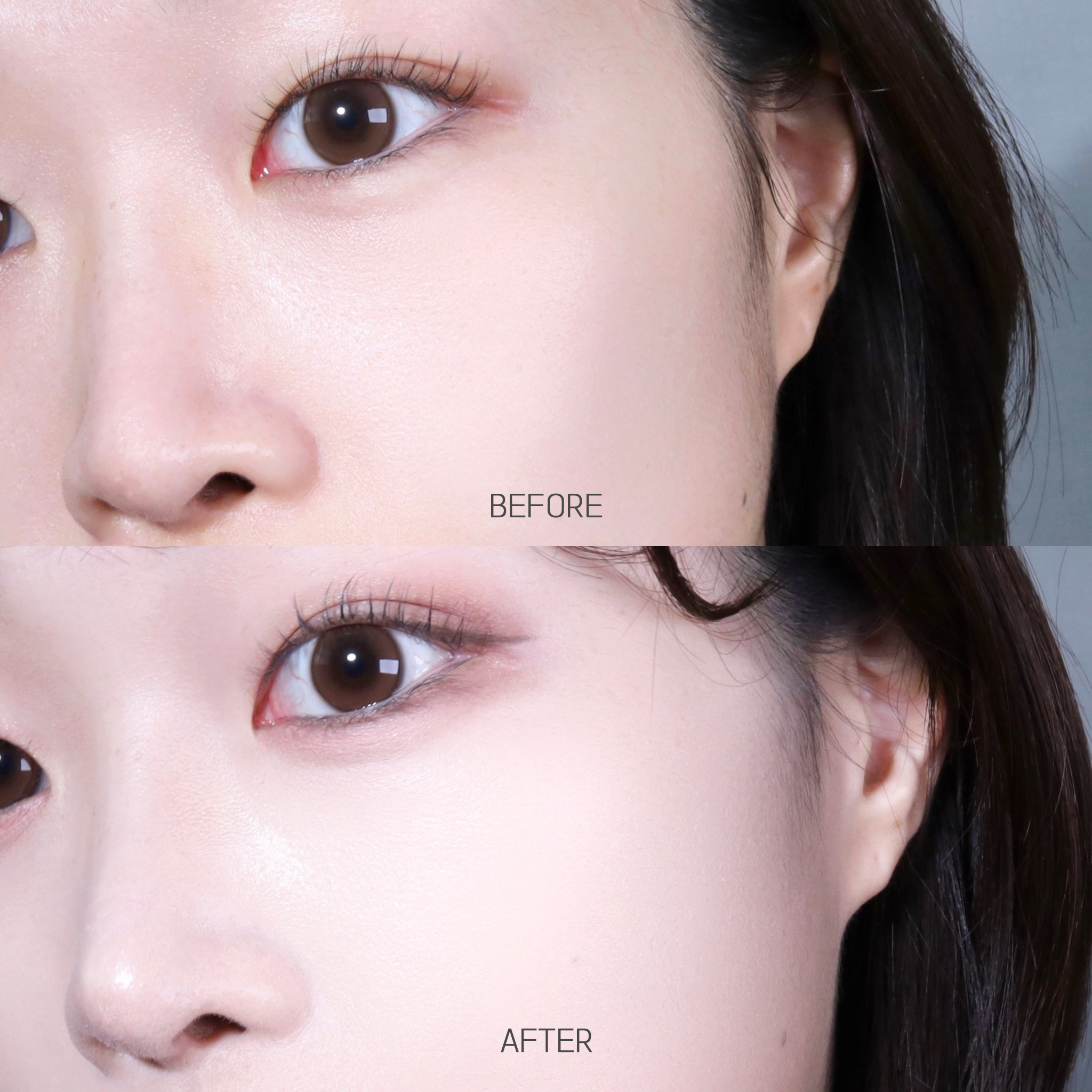 피드이미지정보-0