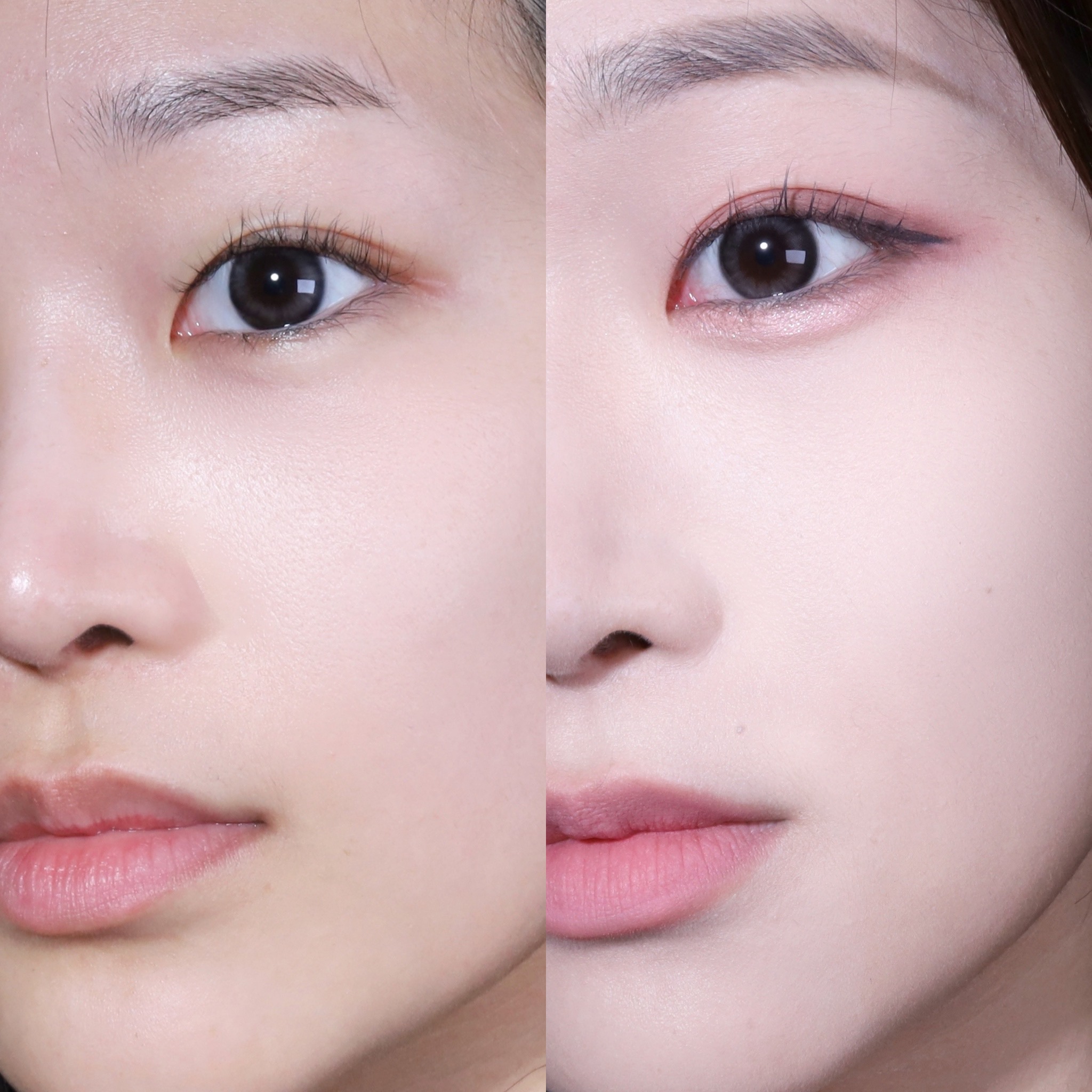 피드이미지정보-4