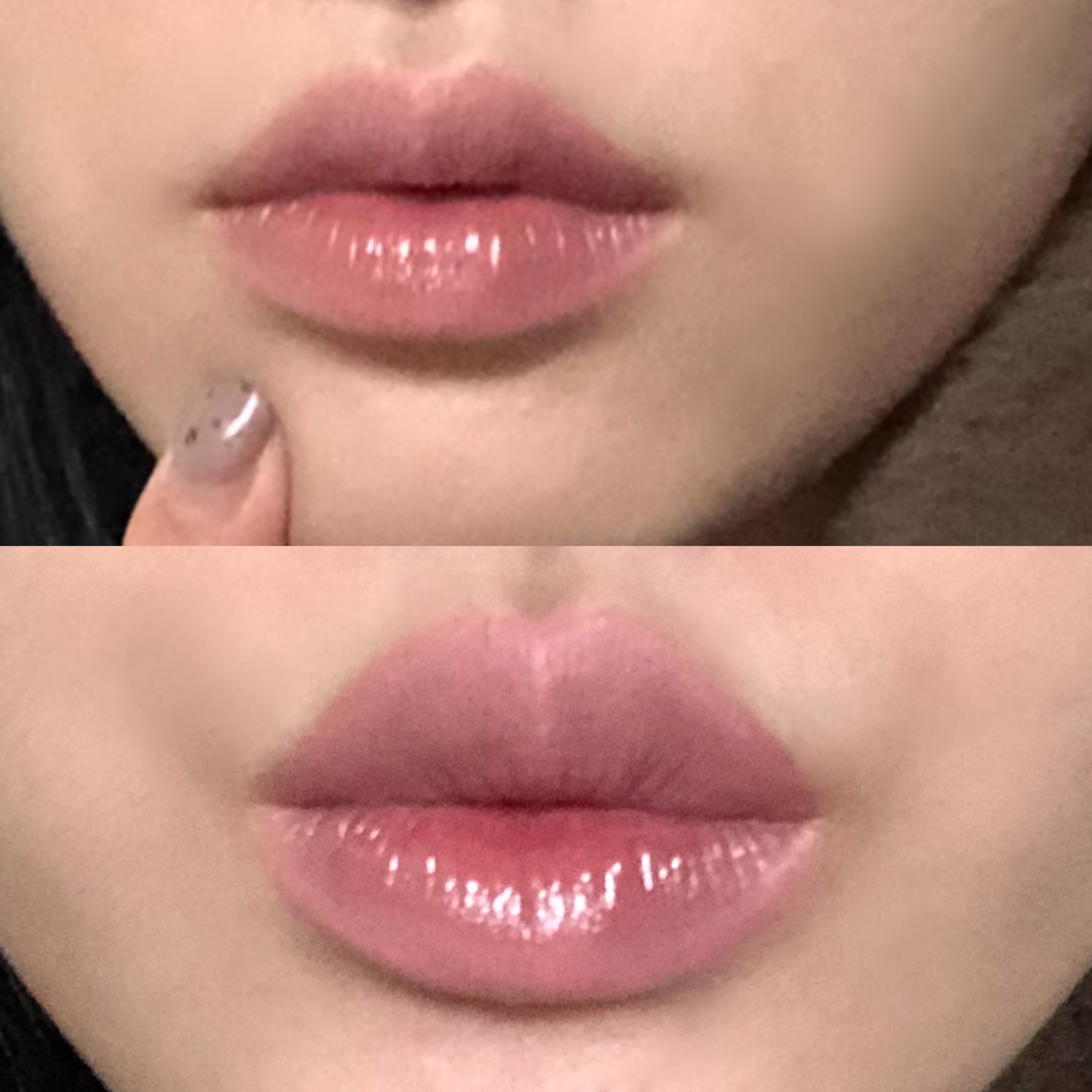 피드이미지정보-0