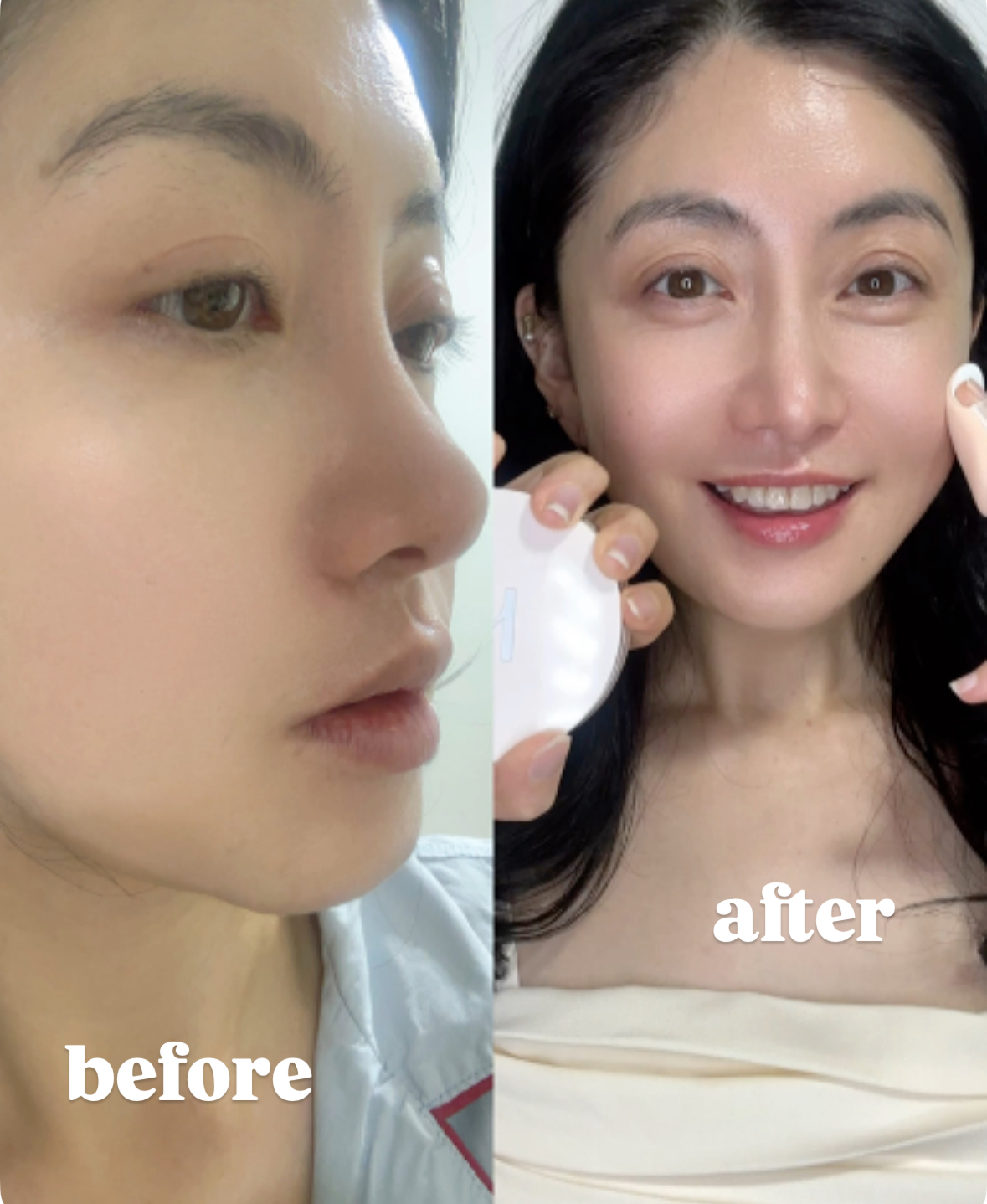 피드이미지정보-4