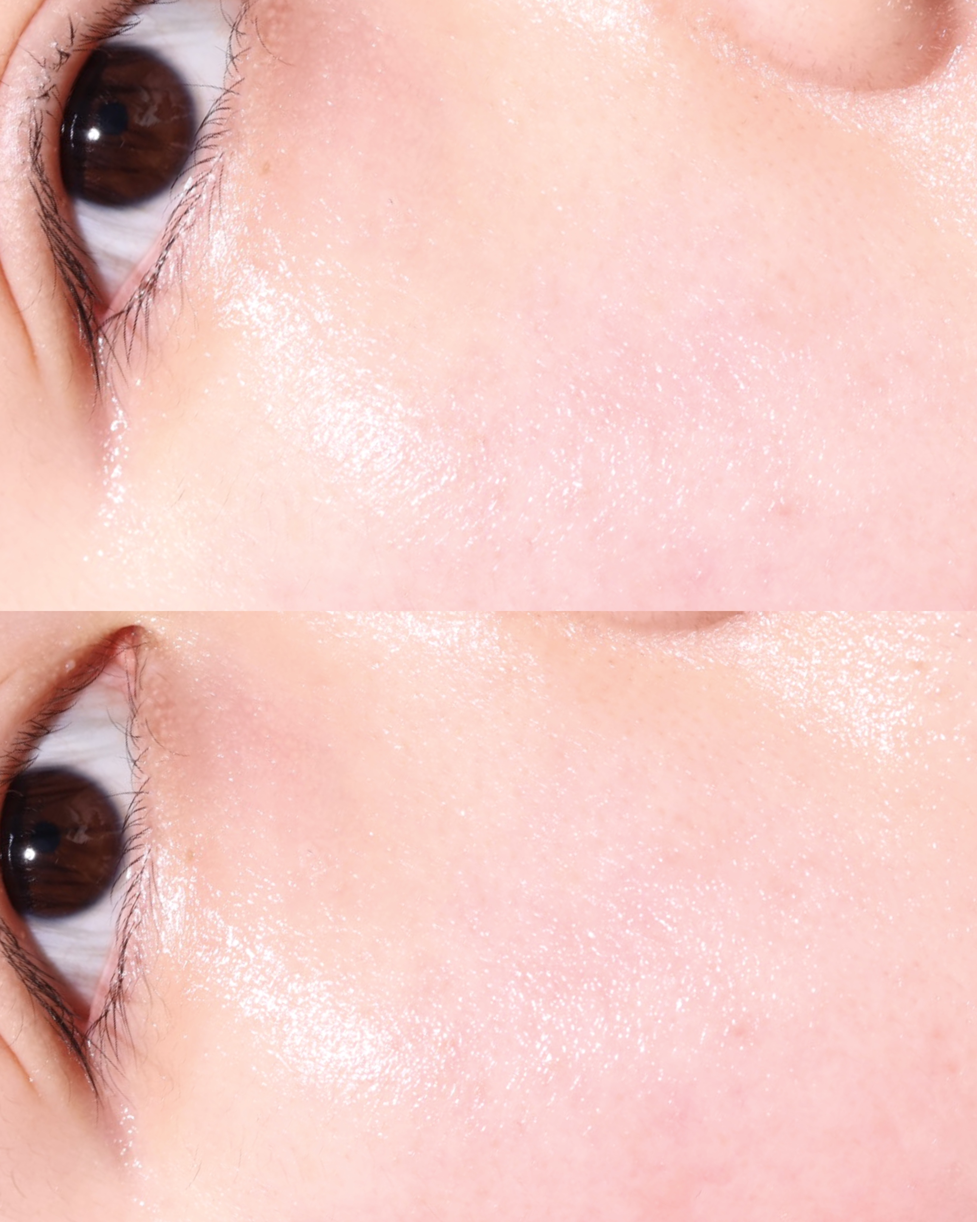 피드이미지정보-3