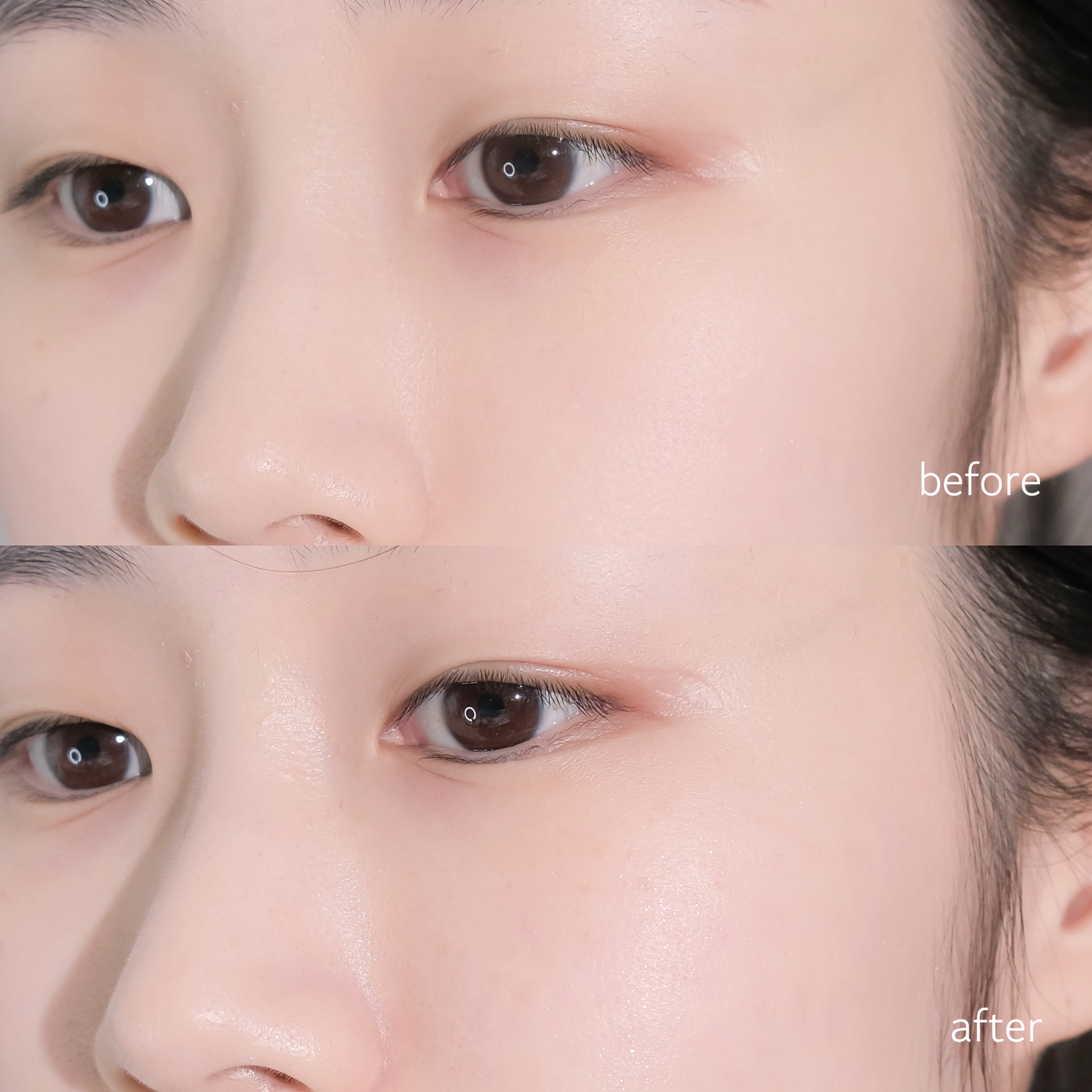 피드이미지정보-7