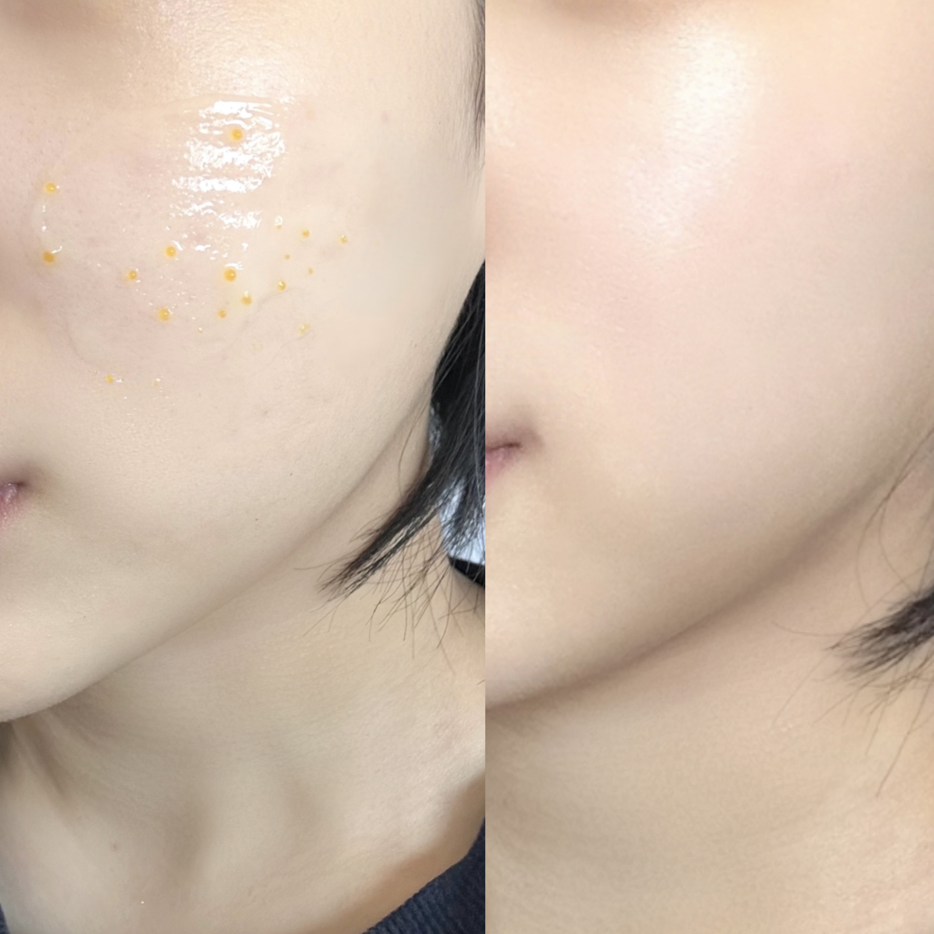 피드이미지정보-6