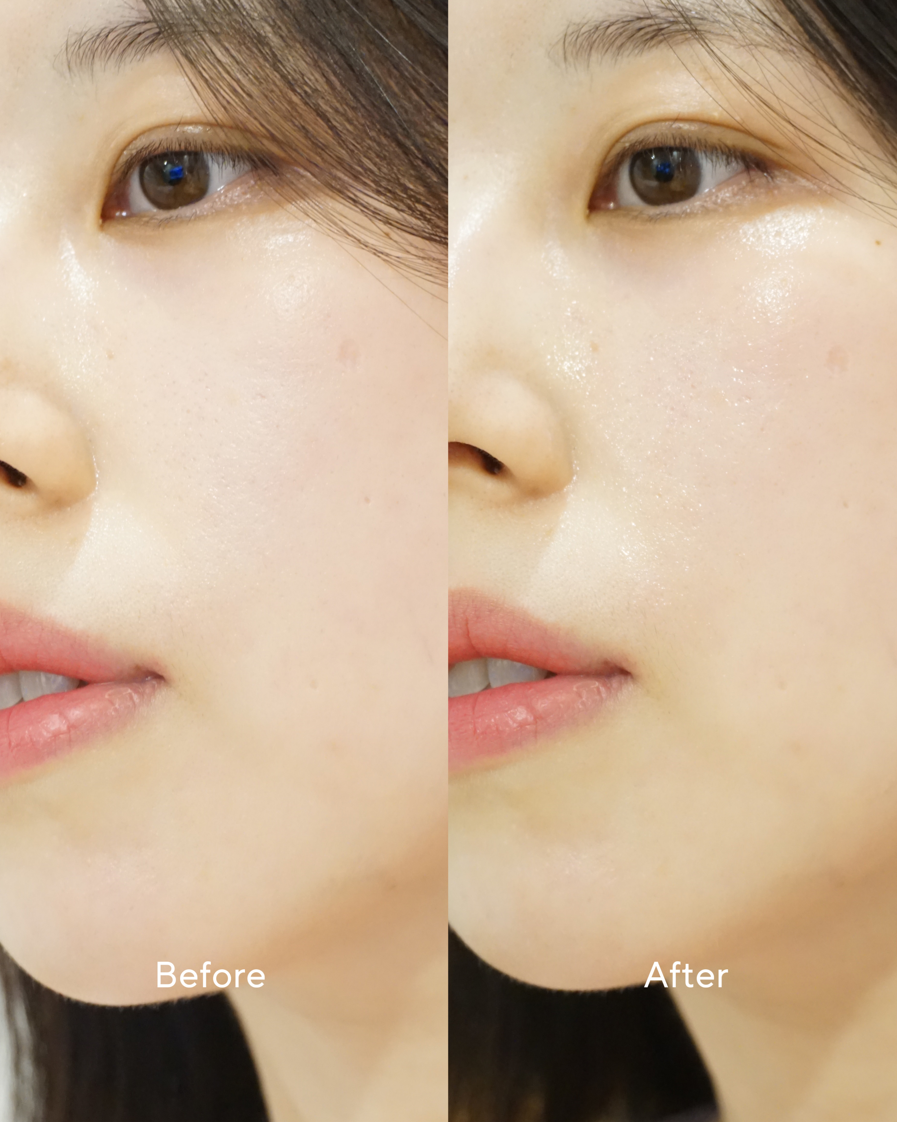 피드이미지정보-1