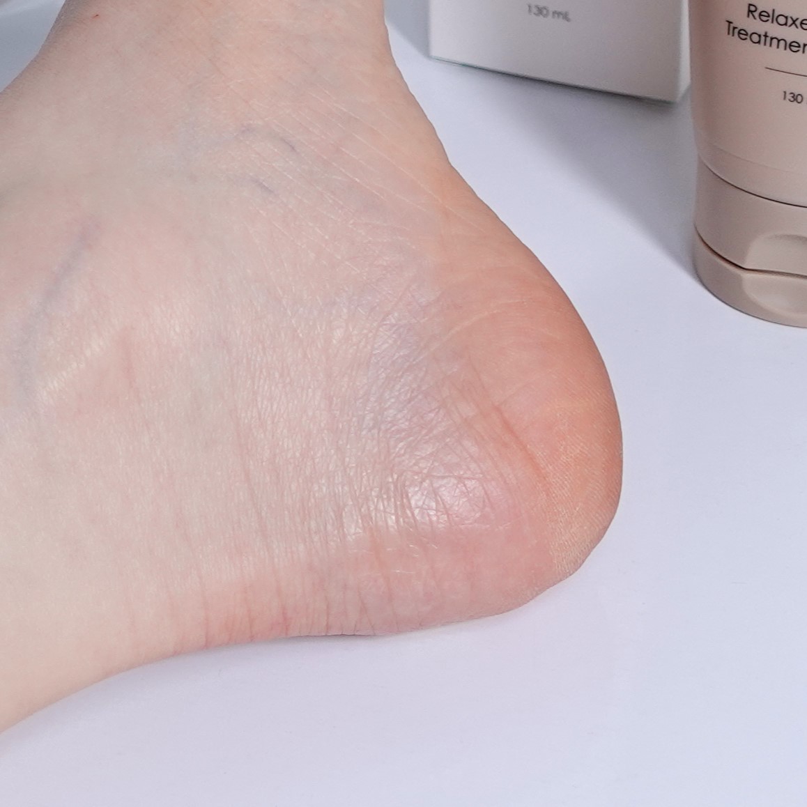 피드이미지정보-7