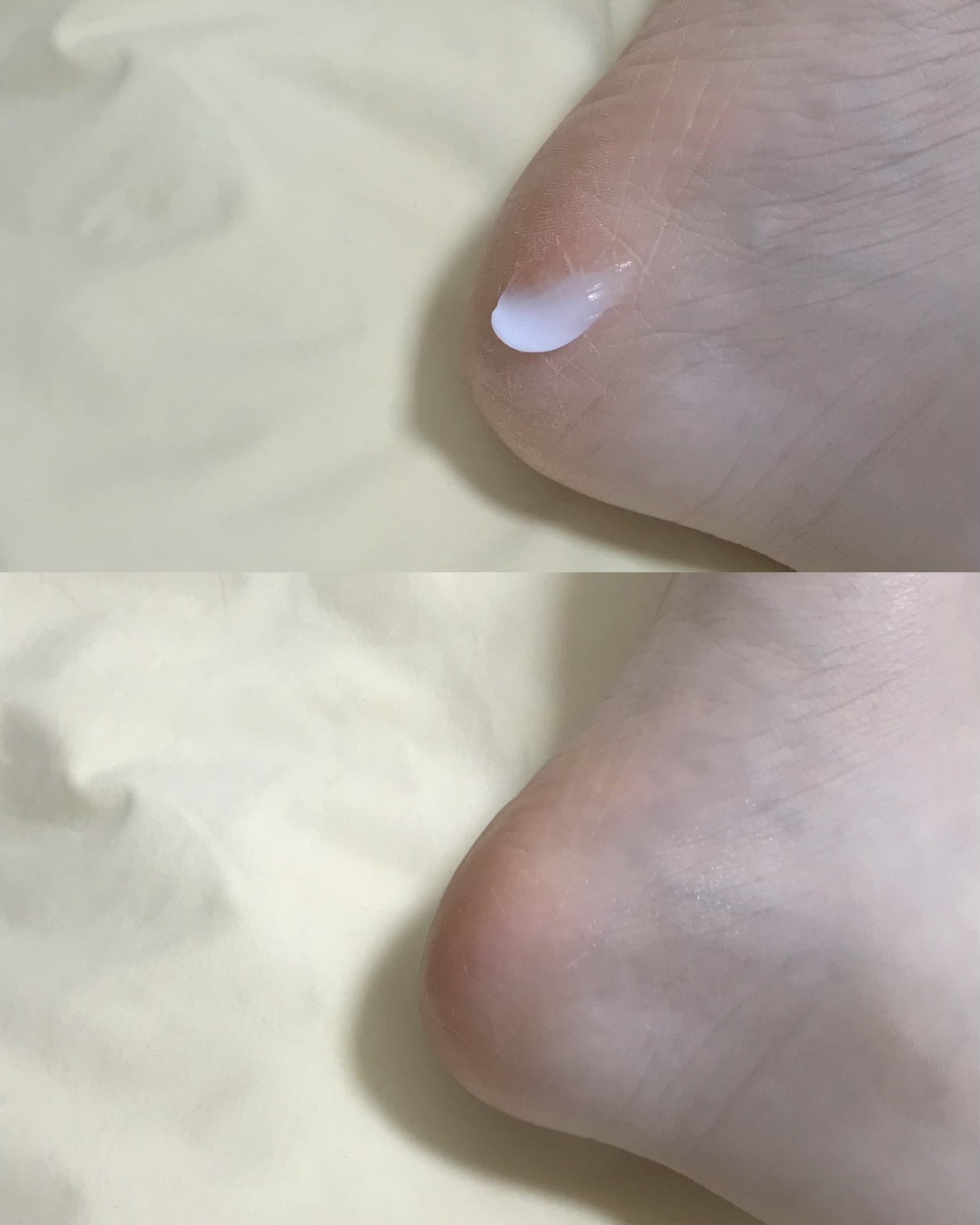 피드이미지정보-2