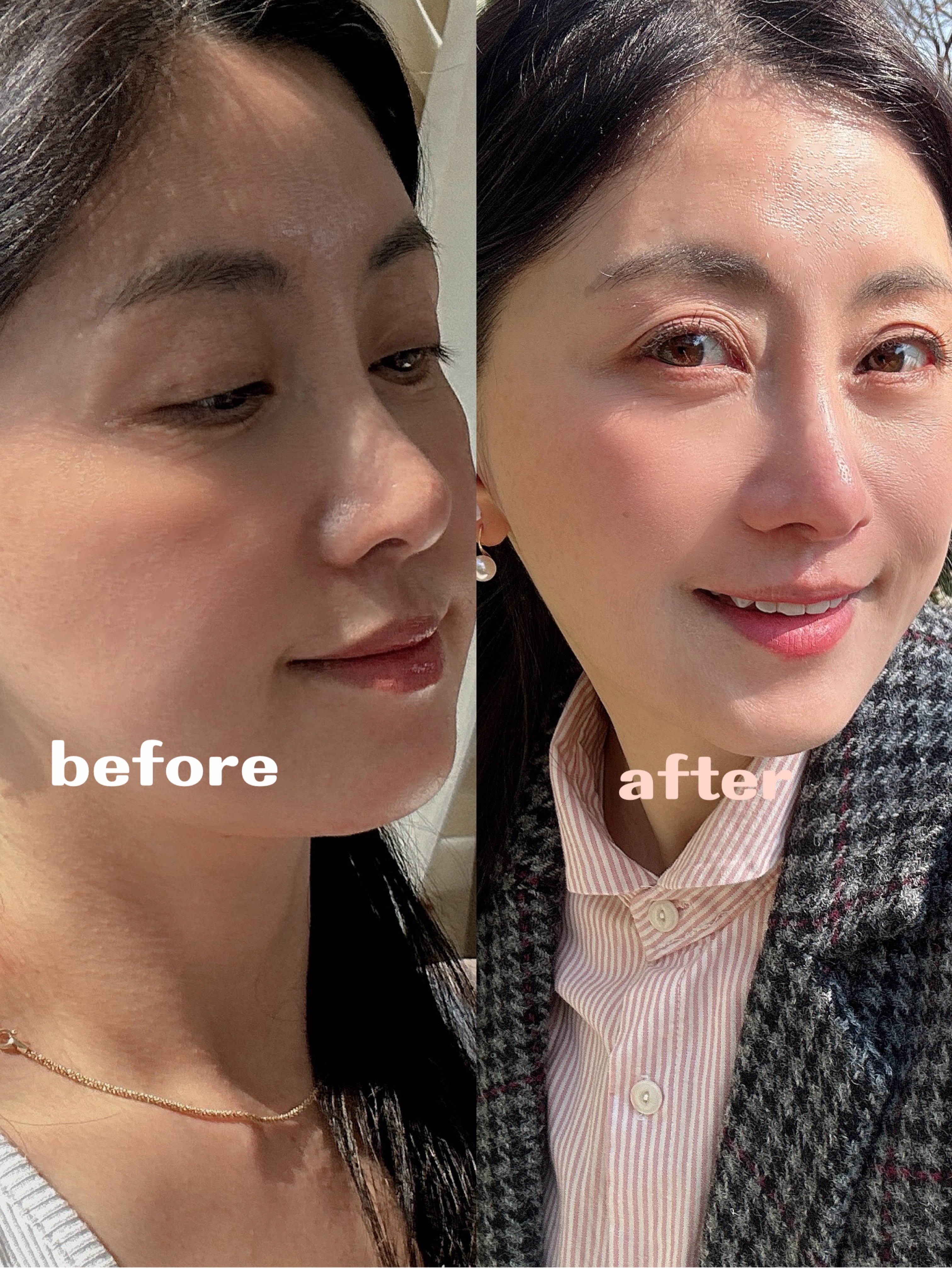 피드이미지정보-2