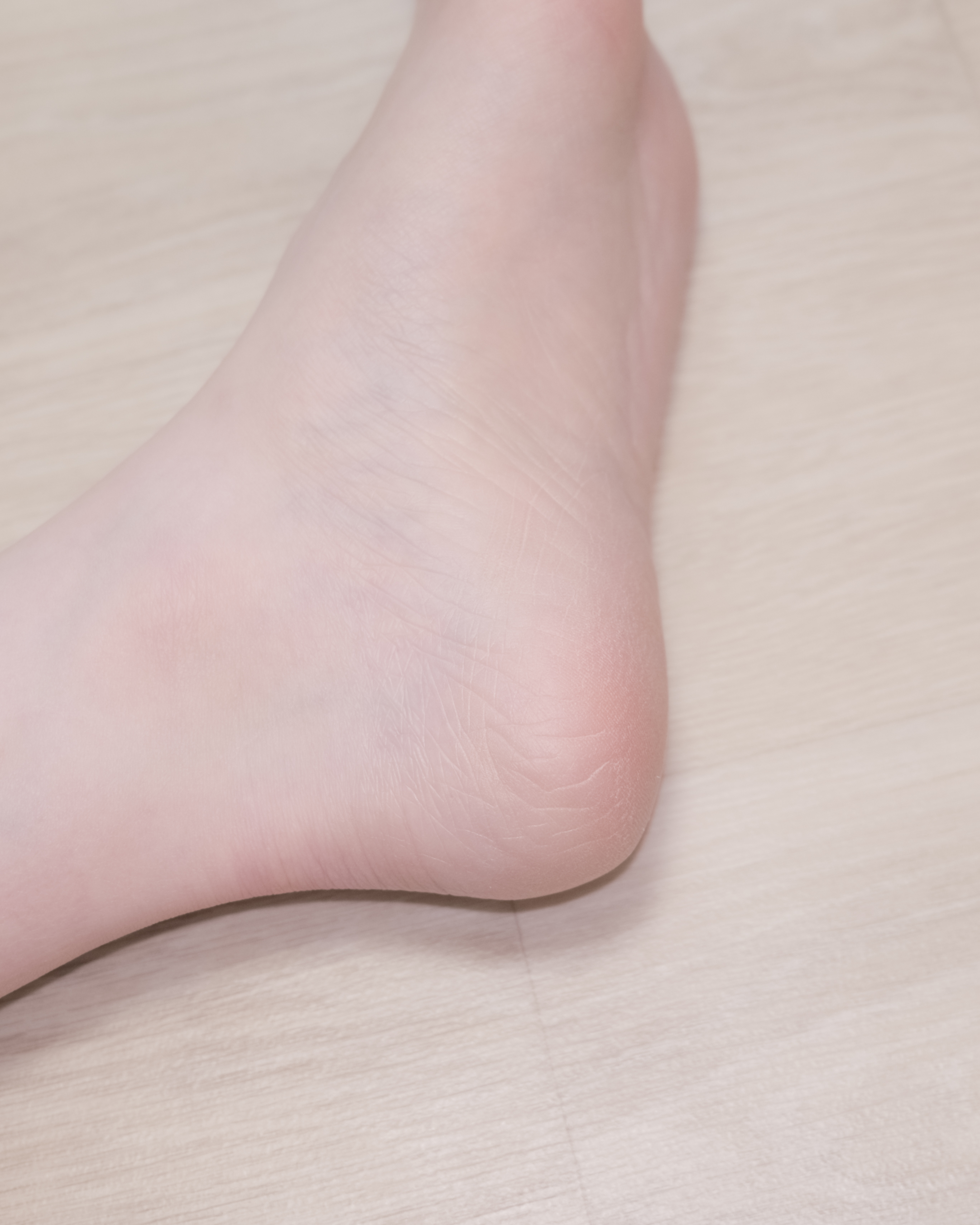 피드이미지정보-8