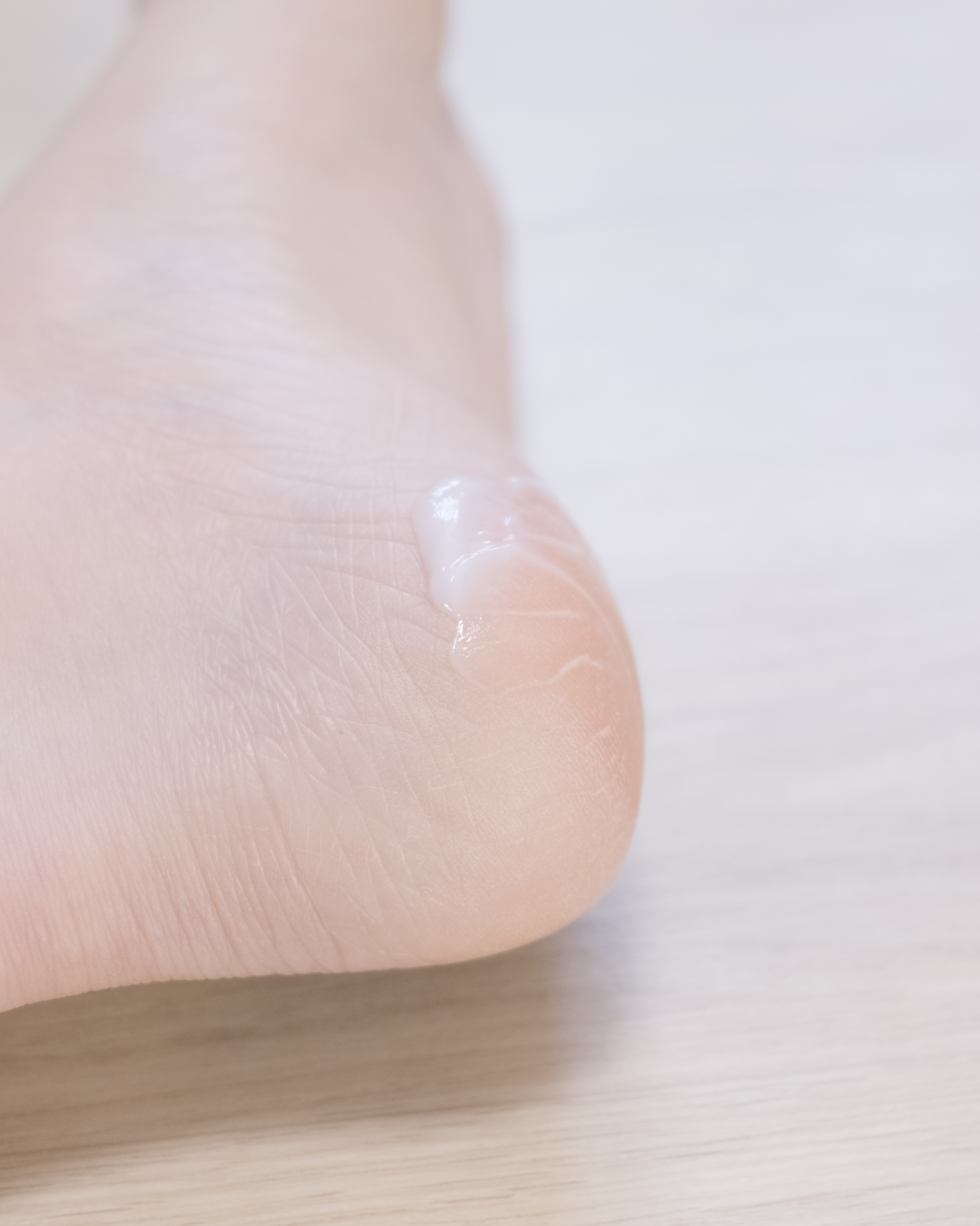 피드이미지정보-6