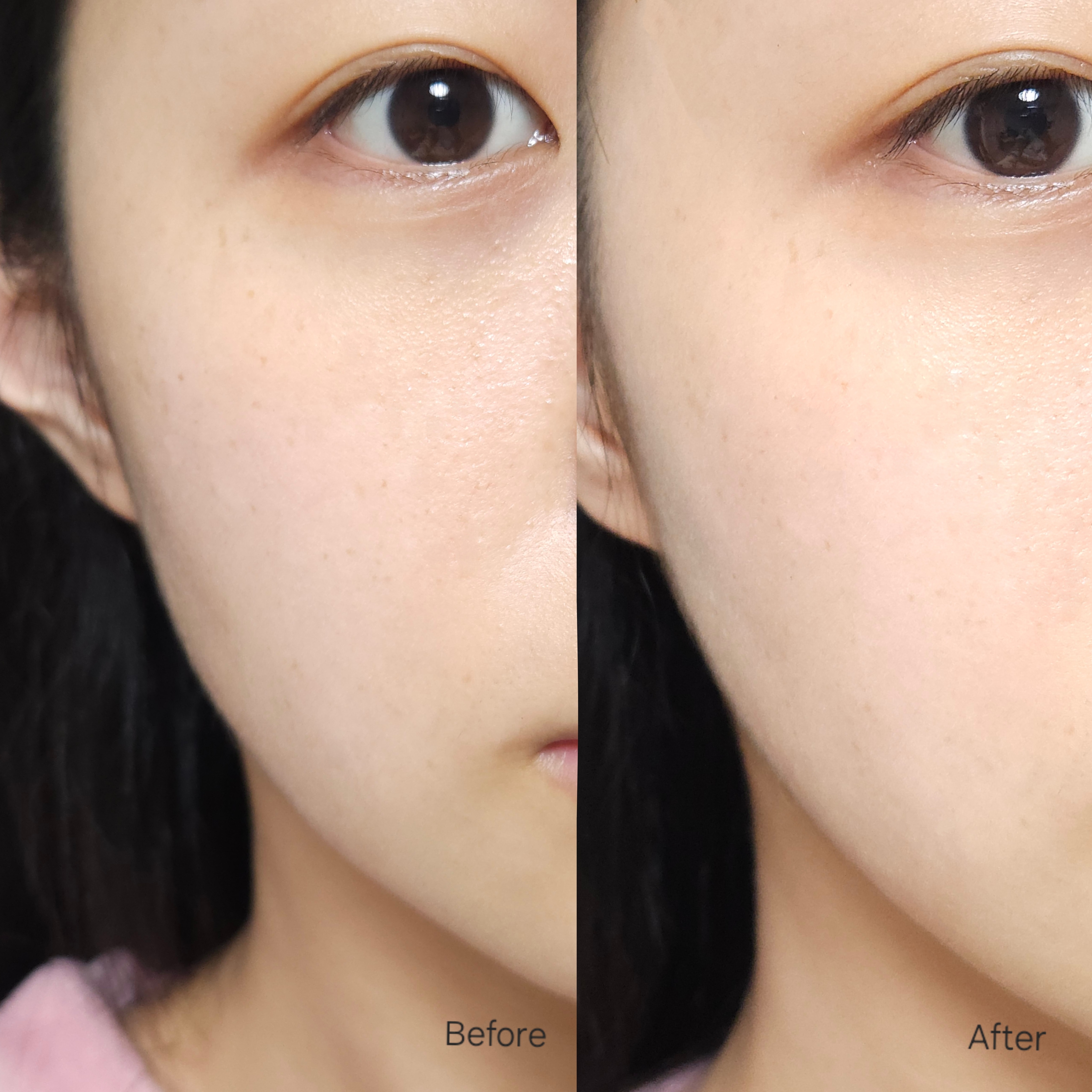 피드이미지정보-6