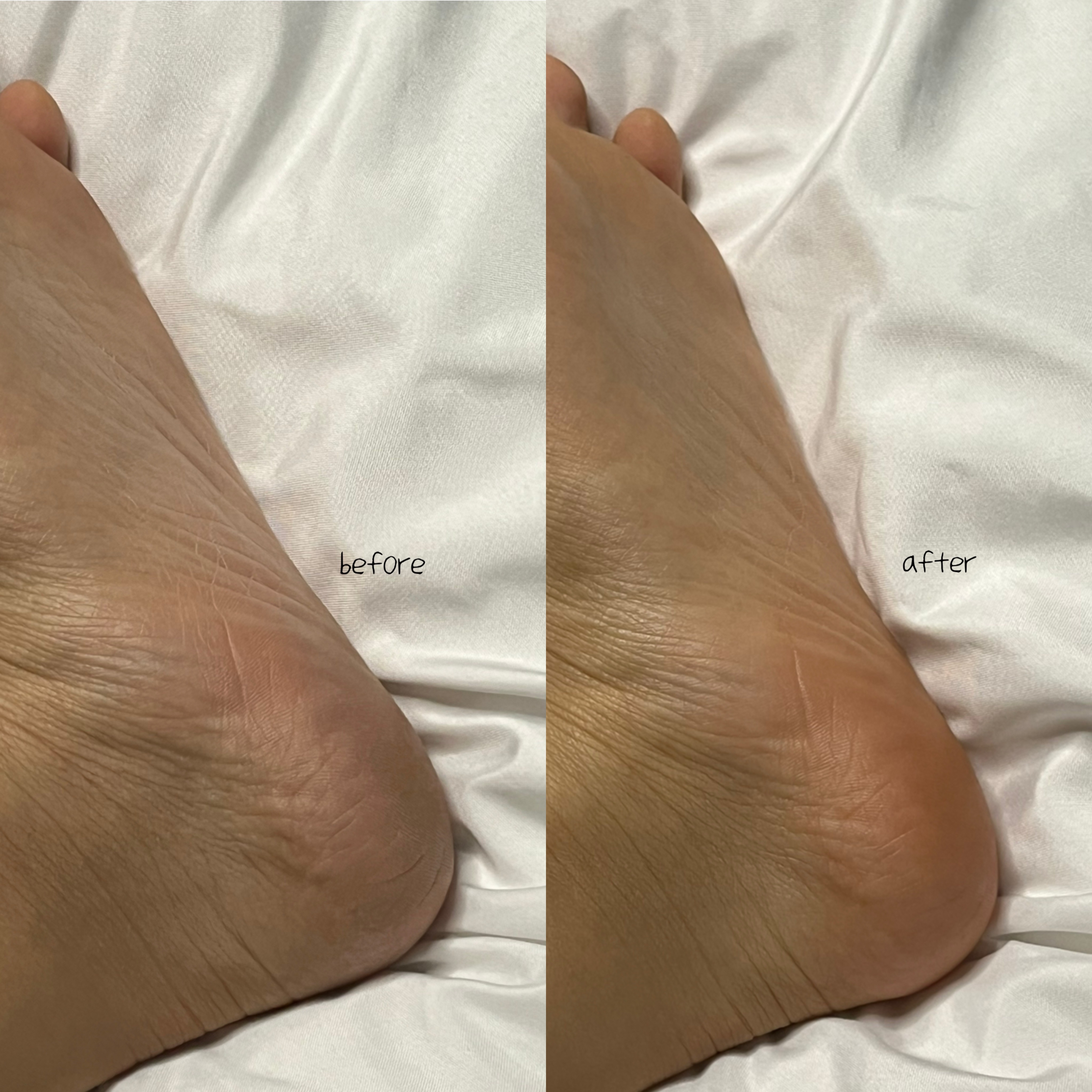 피드이미지정보-1