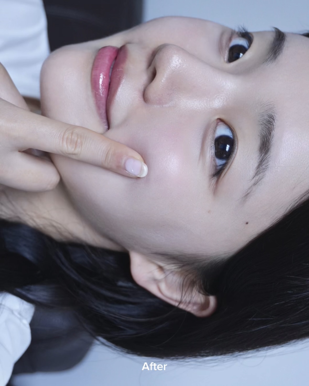 피드이미지정보-5