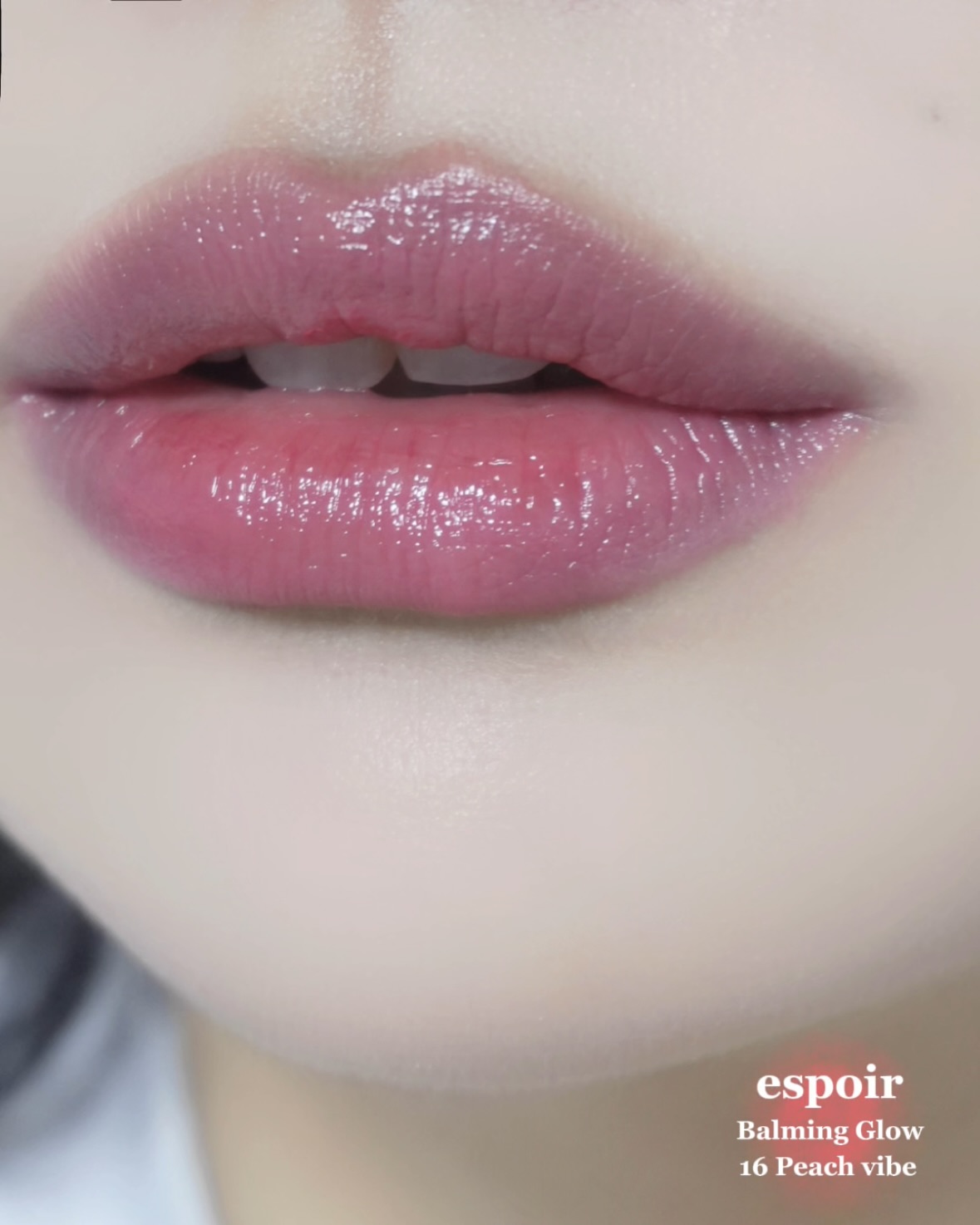 피드이미지정보-7