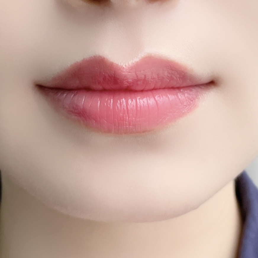 피드이미지정보-6