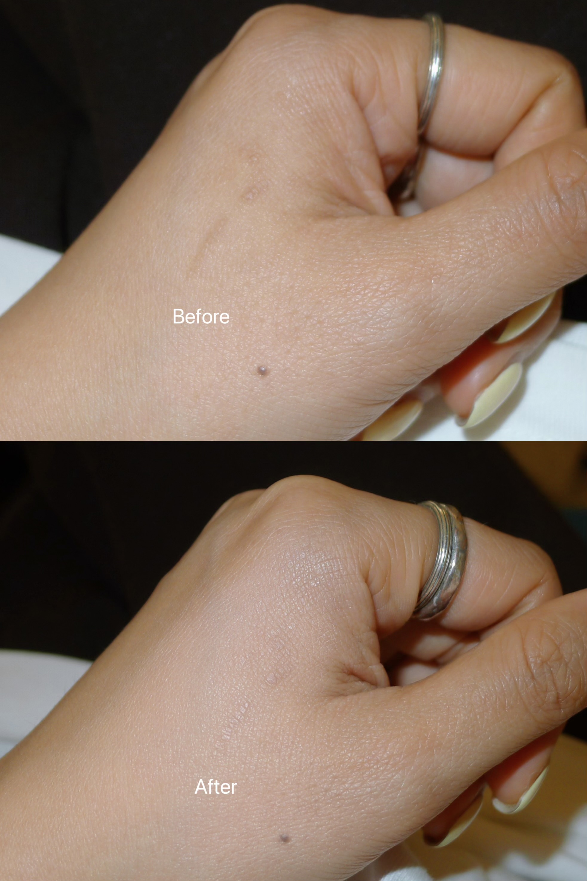 피드이미지정보-1